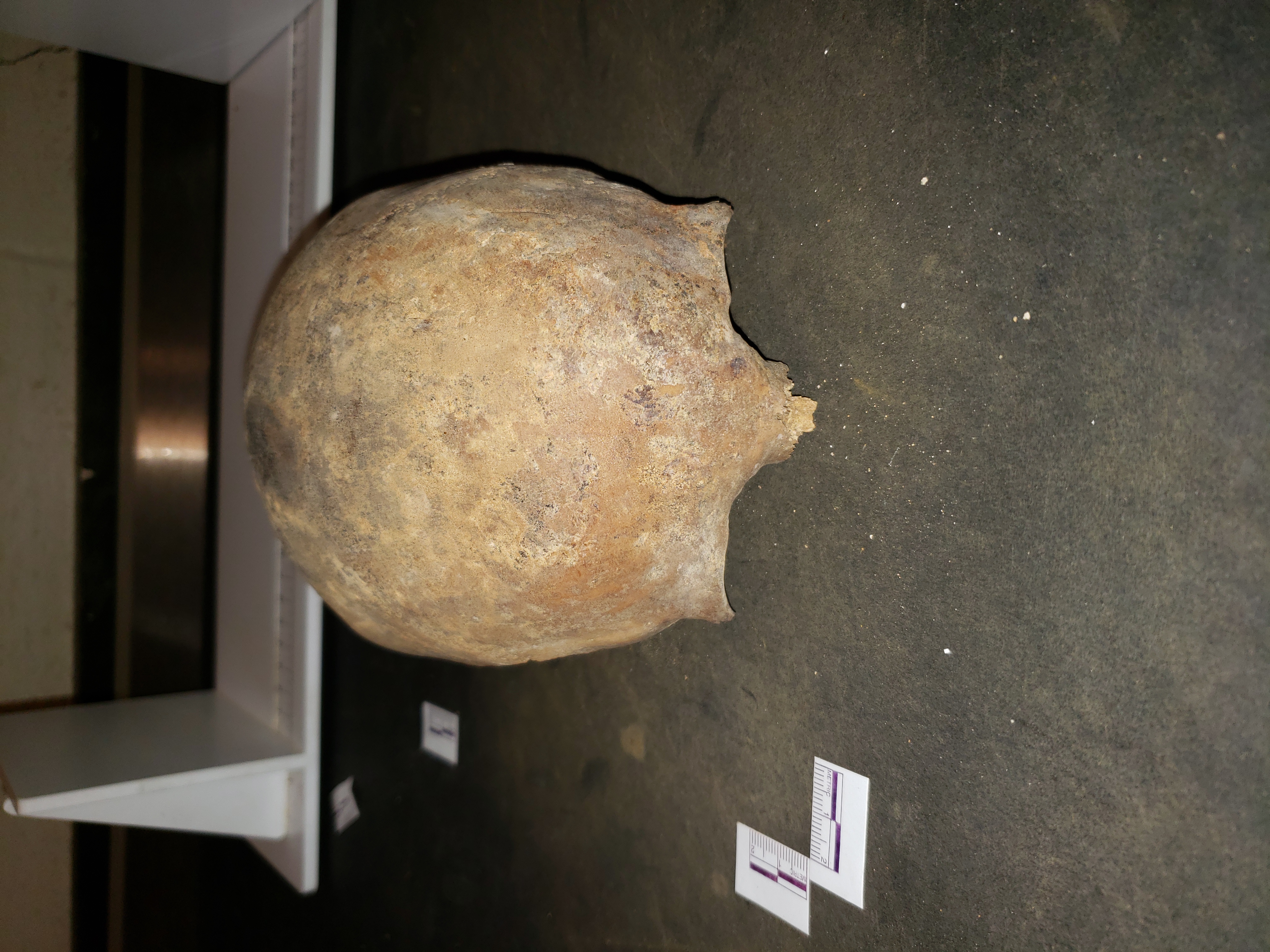 Anterior view