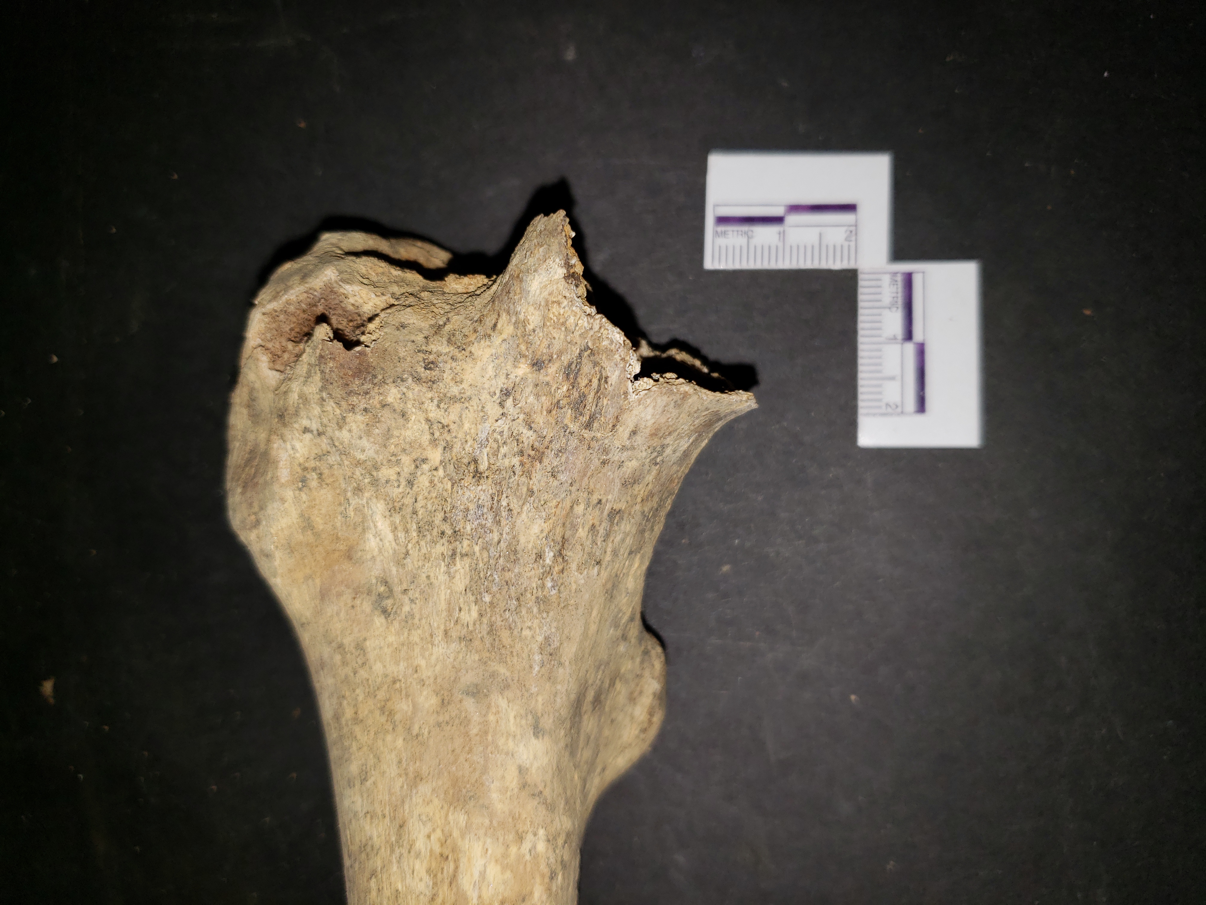 Proximal End of Femur (anterior)