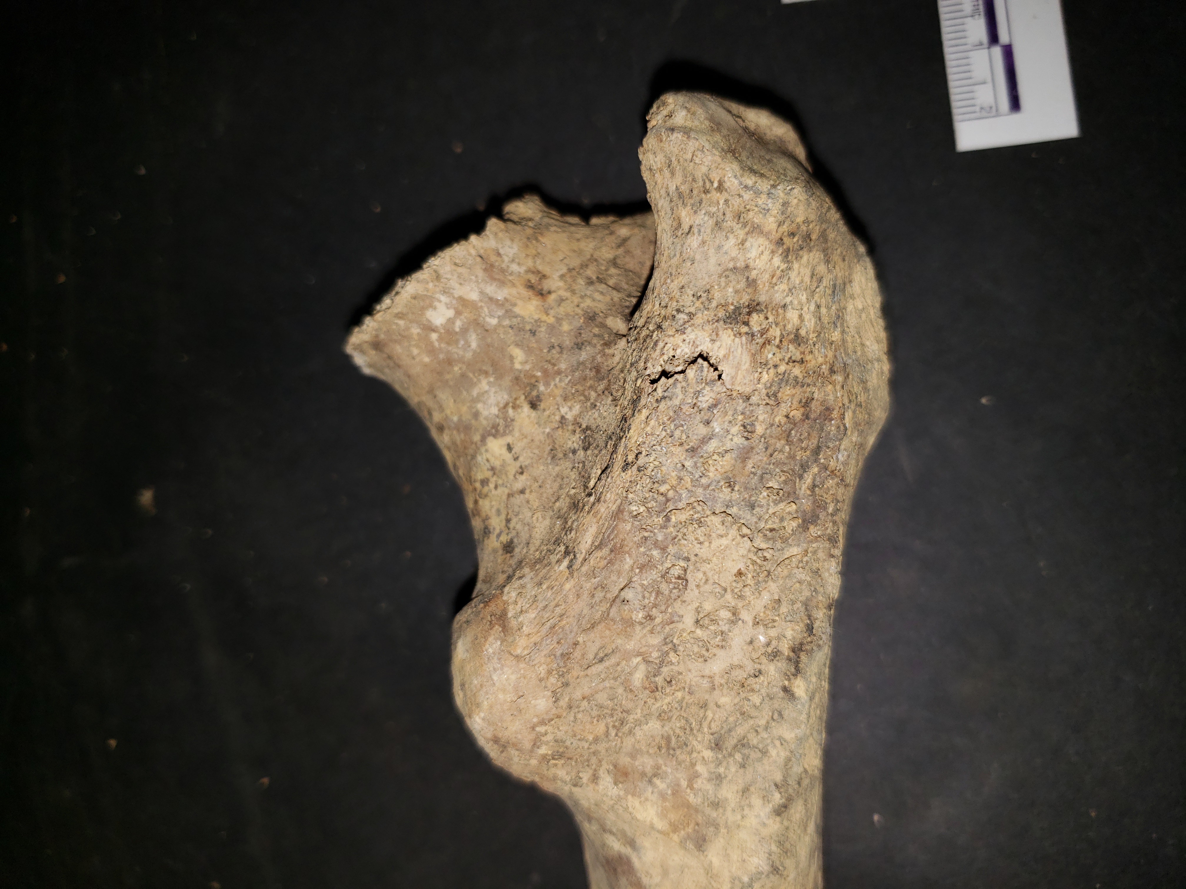 Proximal End of Femur (posterior)