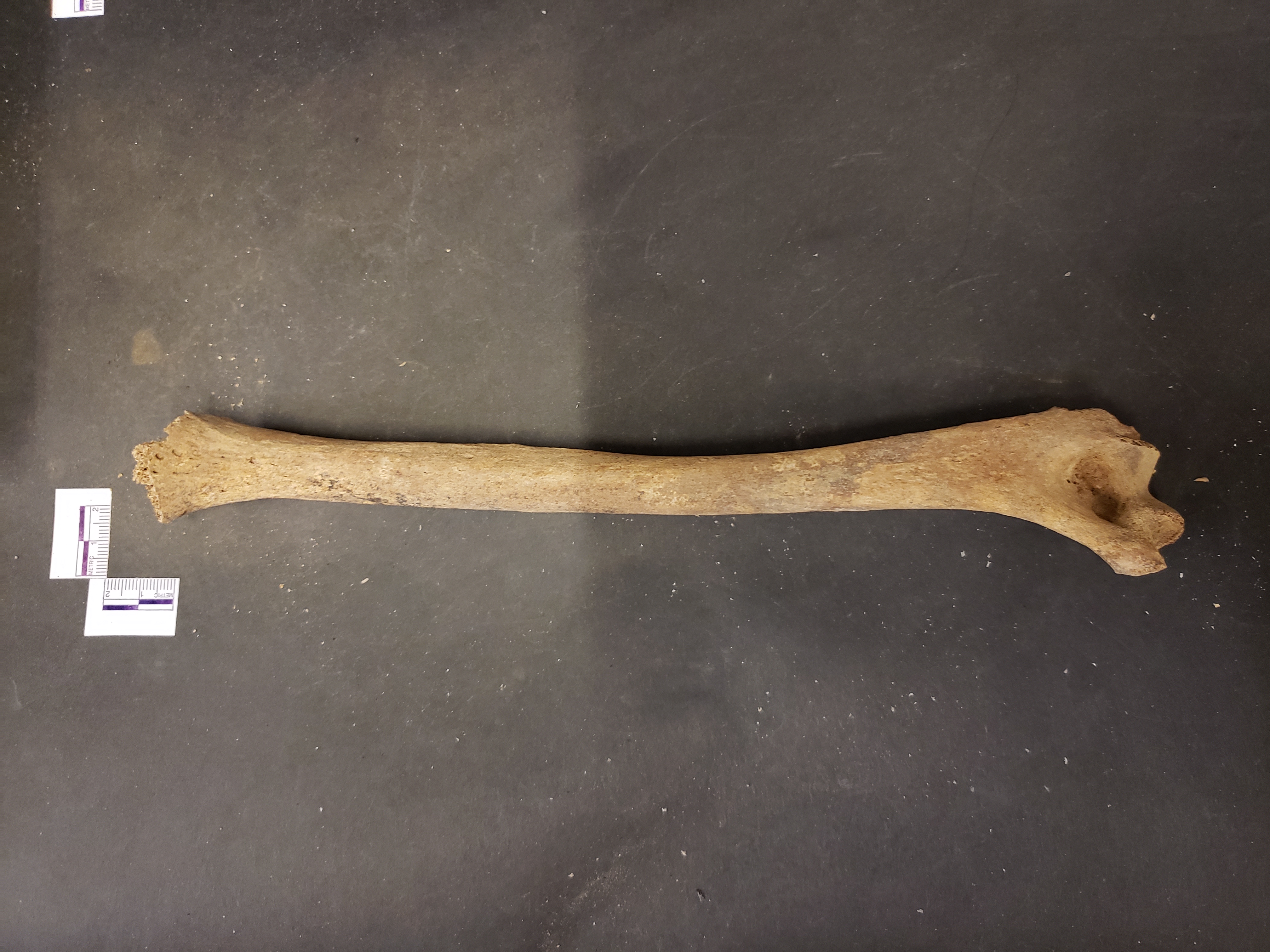 Posterior view (distal down)