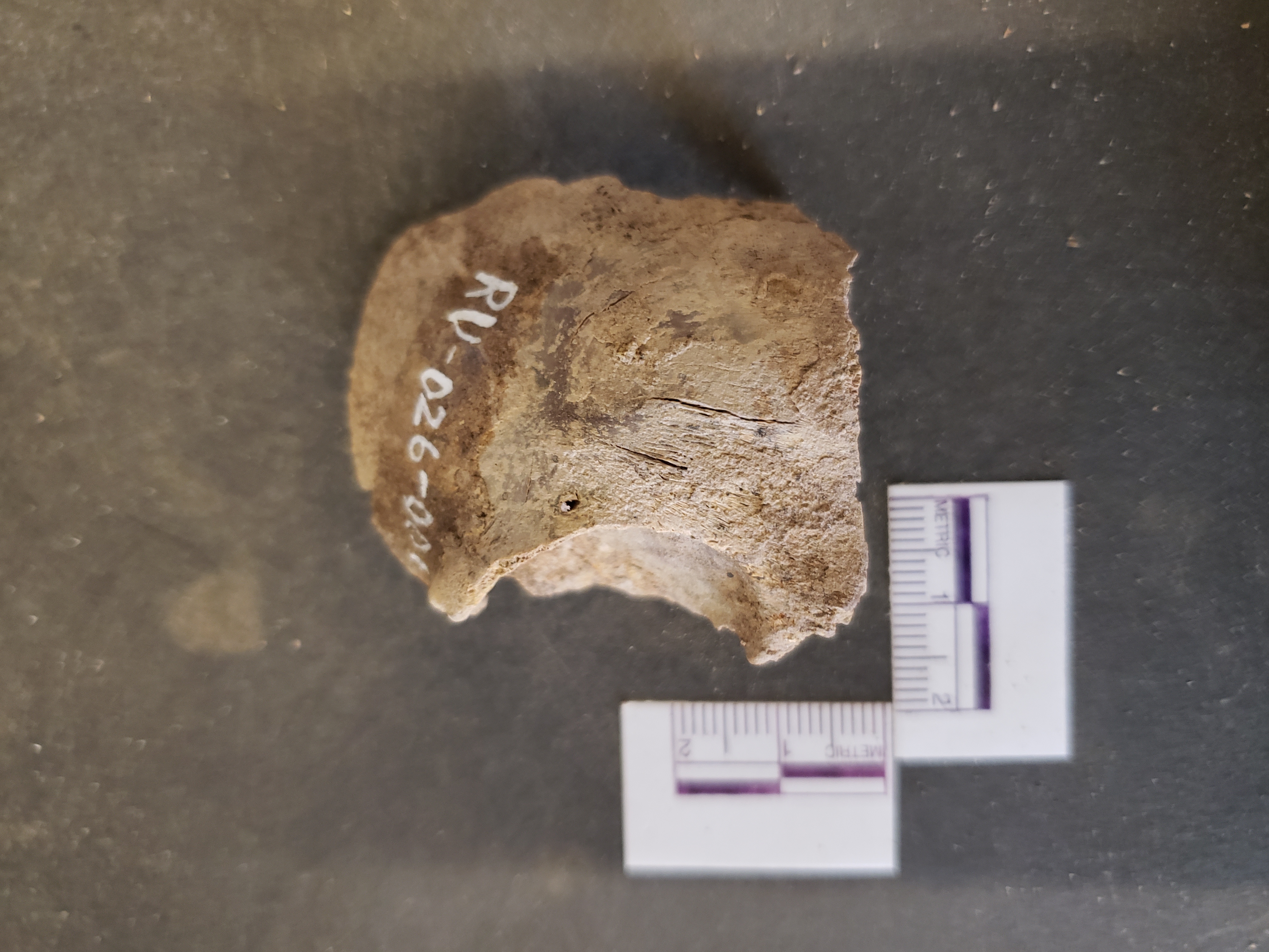 Anterior view