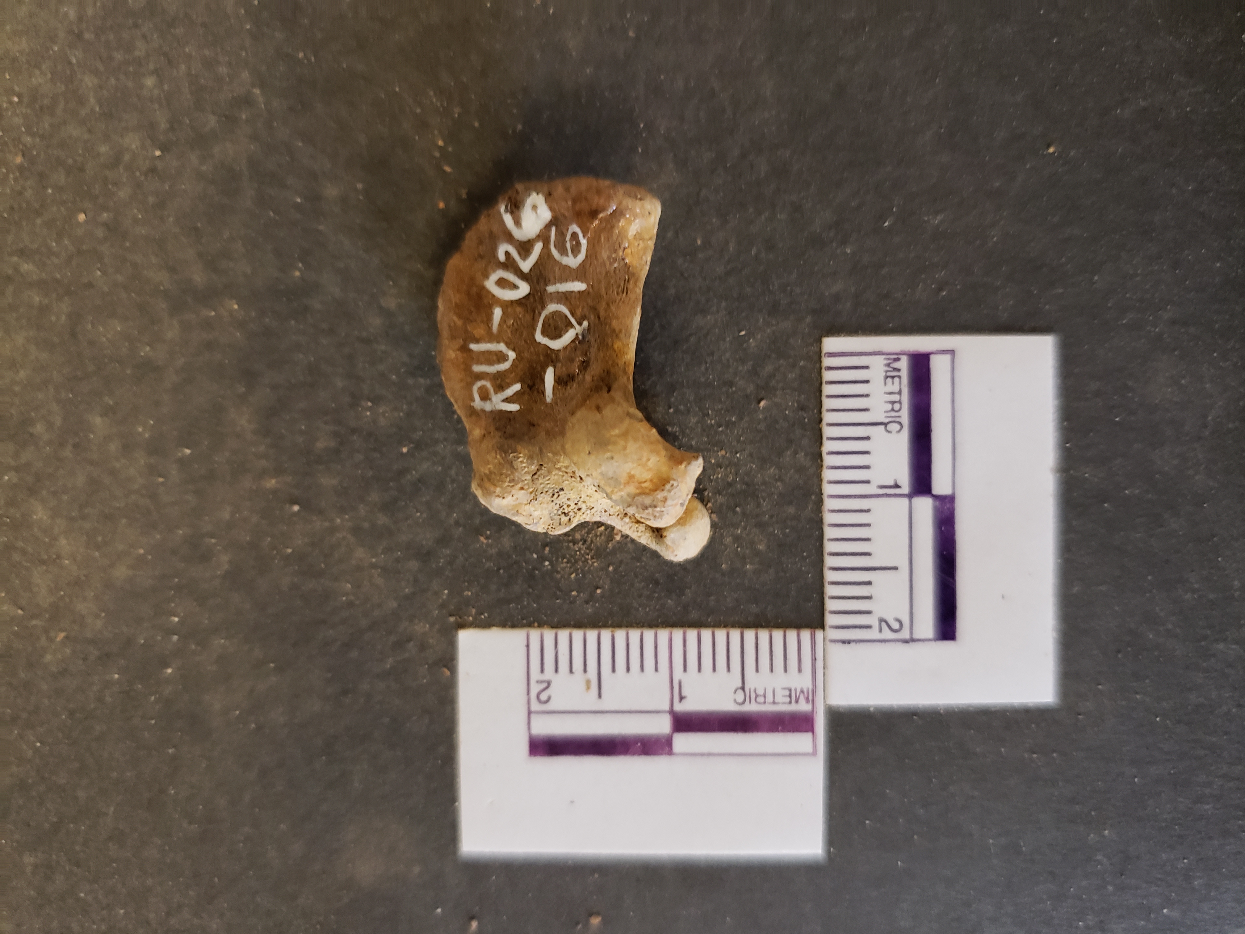 Anterior view
