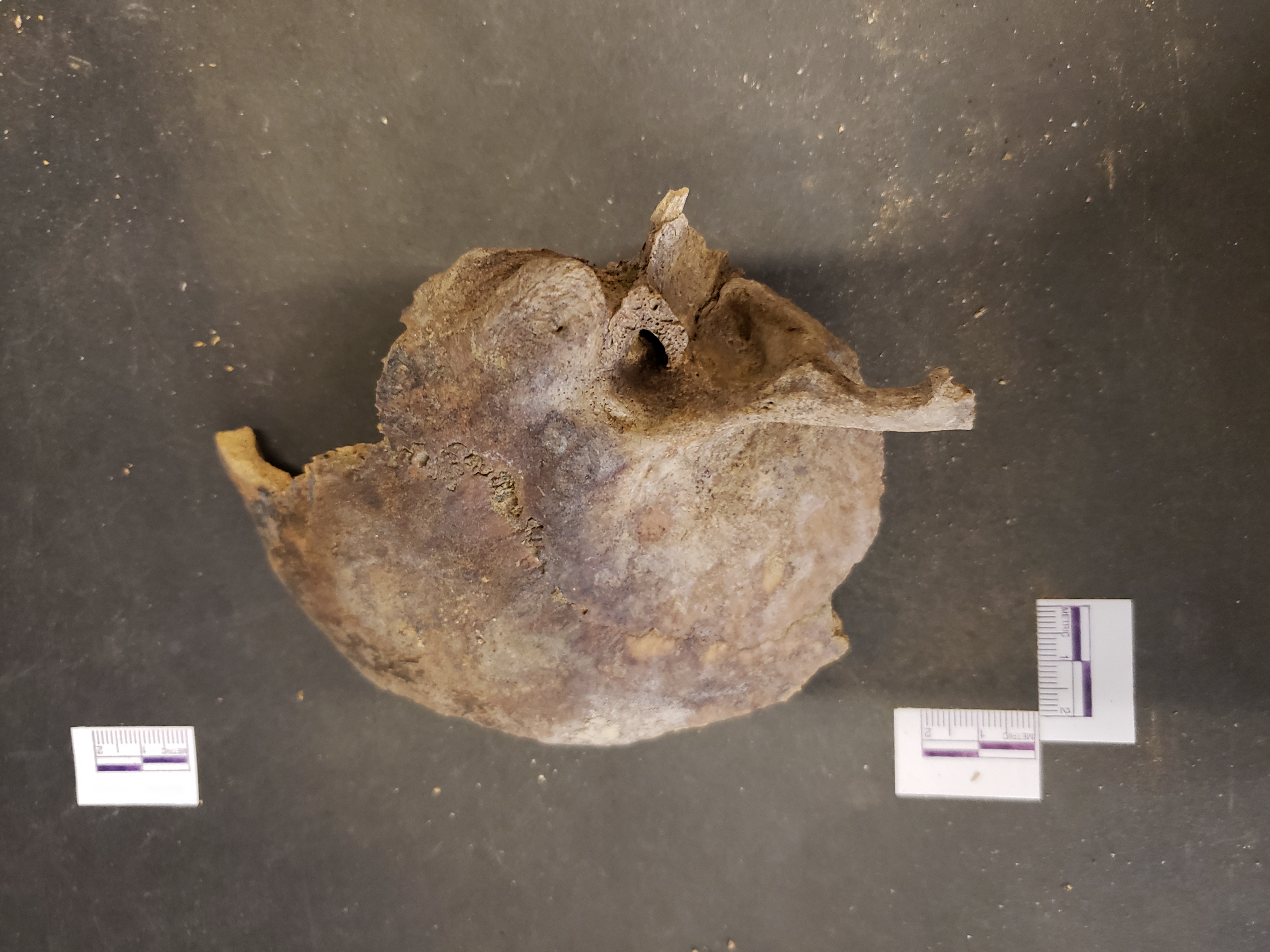 Ectocranial view (anterior down)