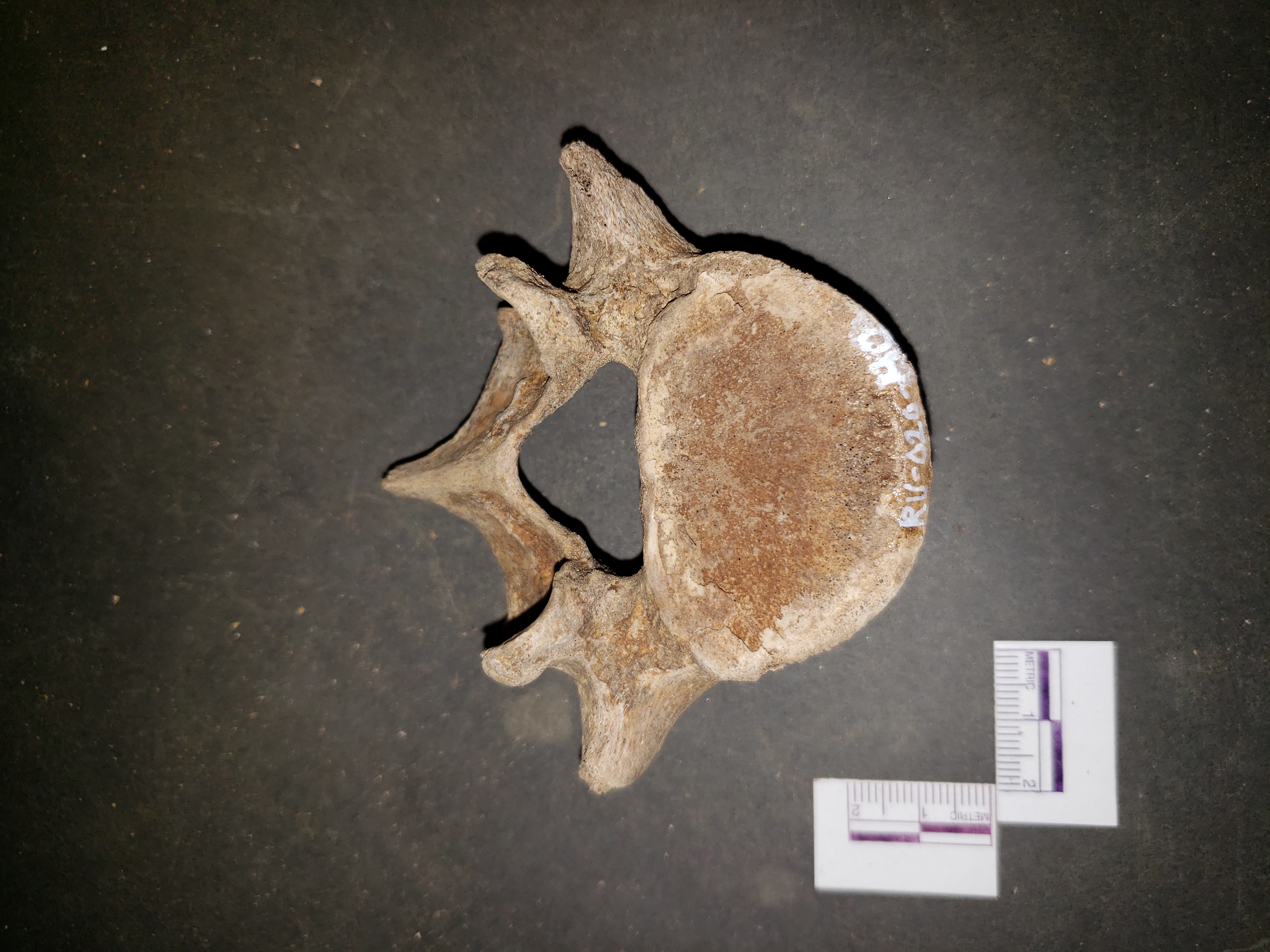 Superior view (posterior up)