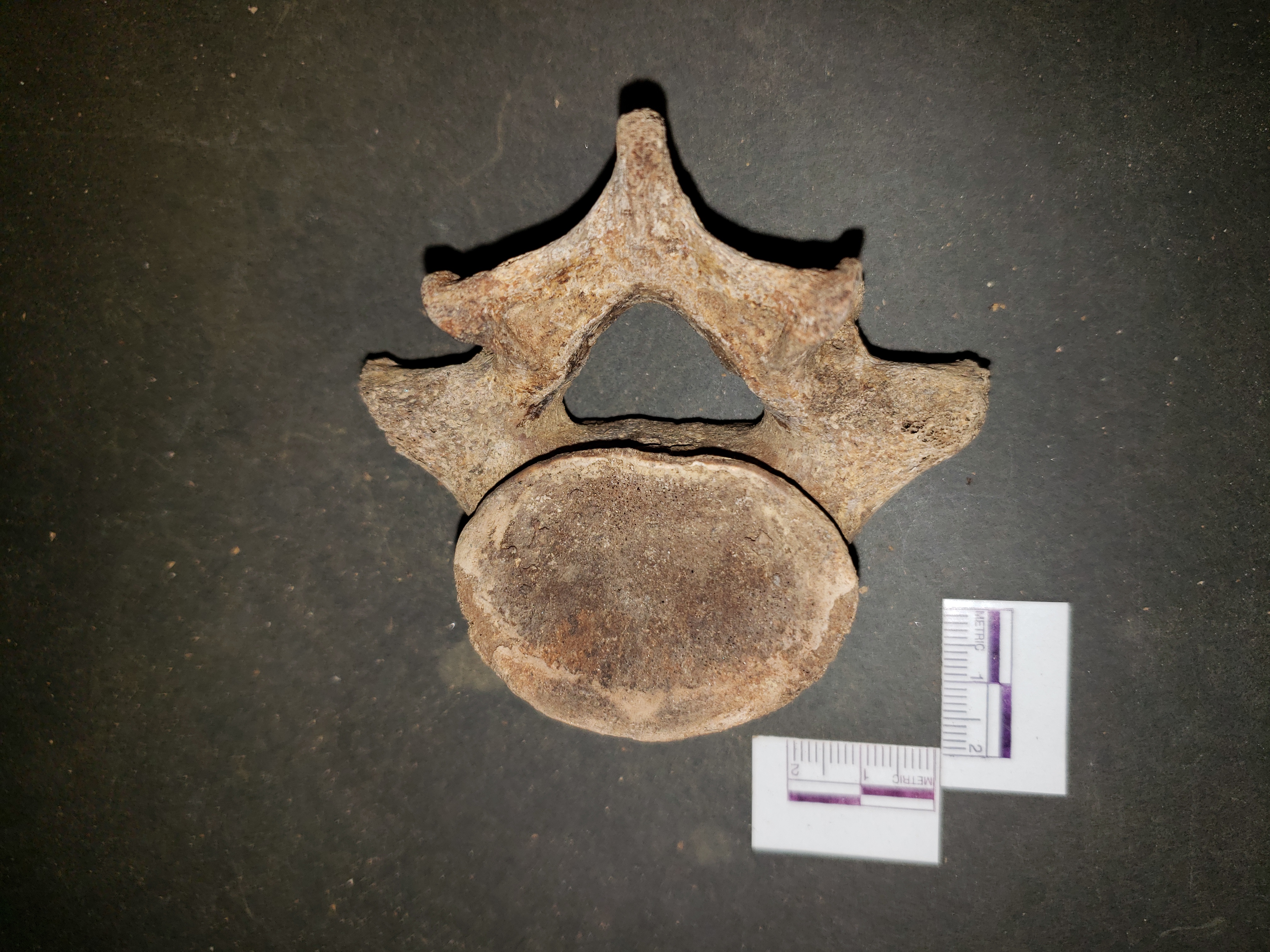 Inferior view (posterior right)