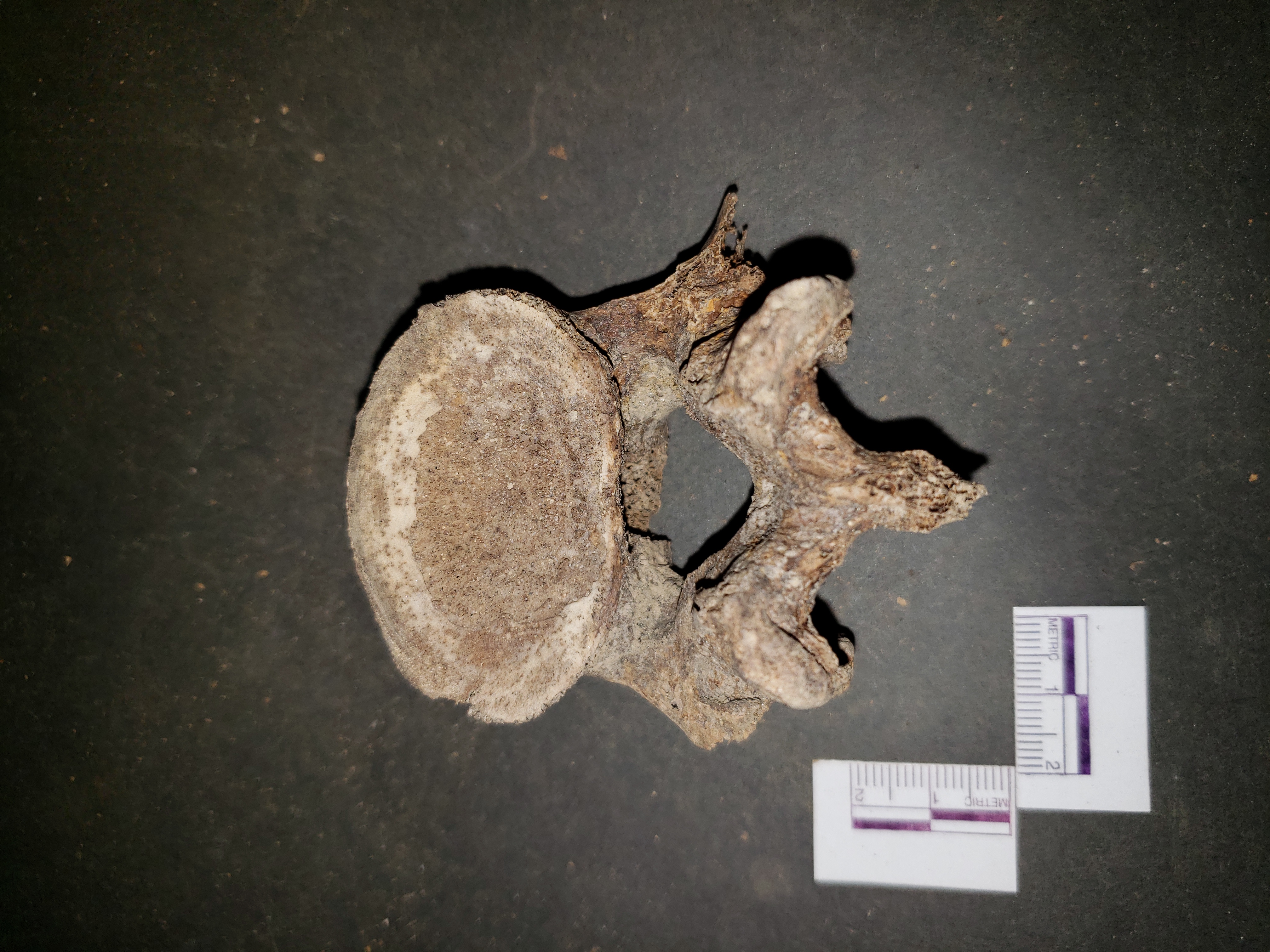 Inferior view (posterior down)