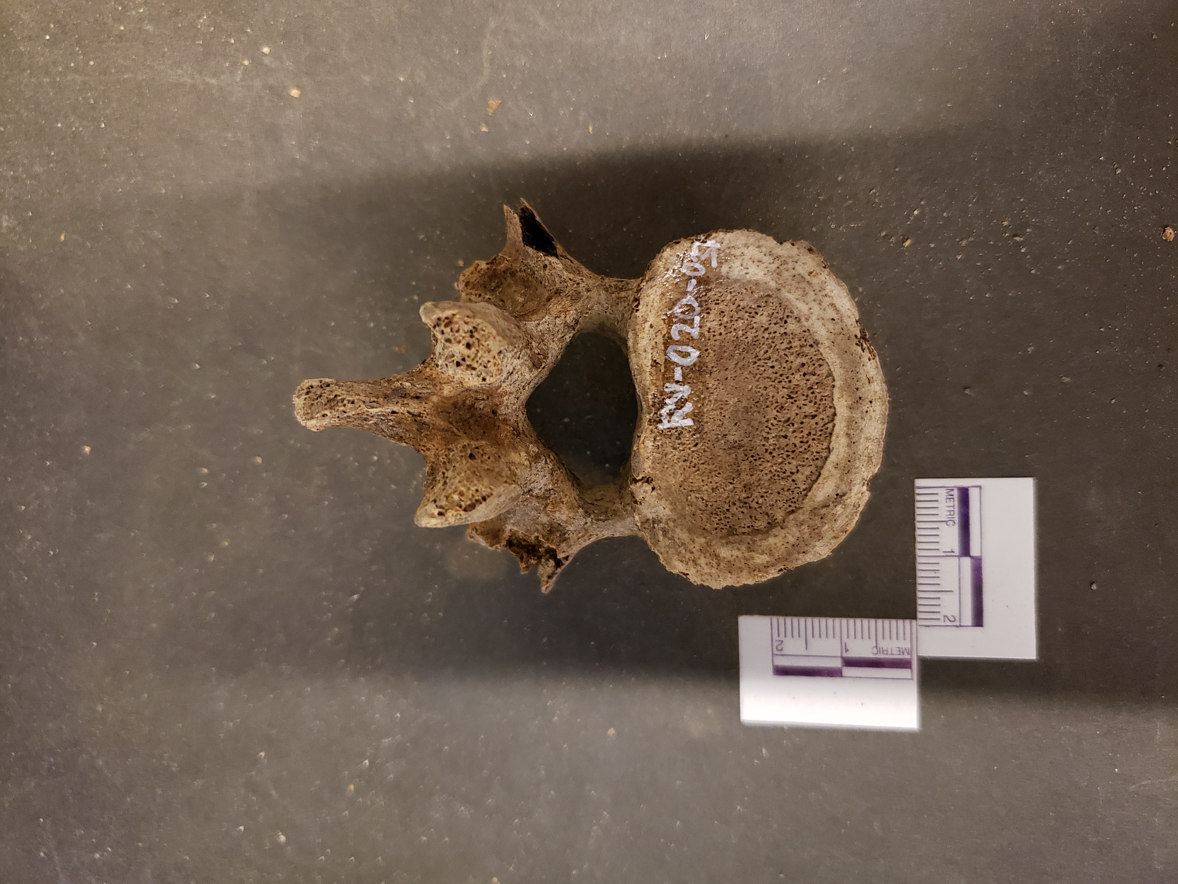Inferior view (posterior up)