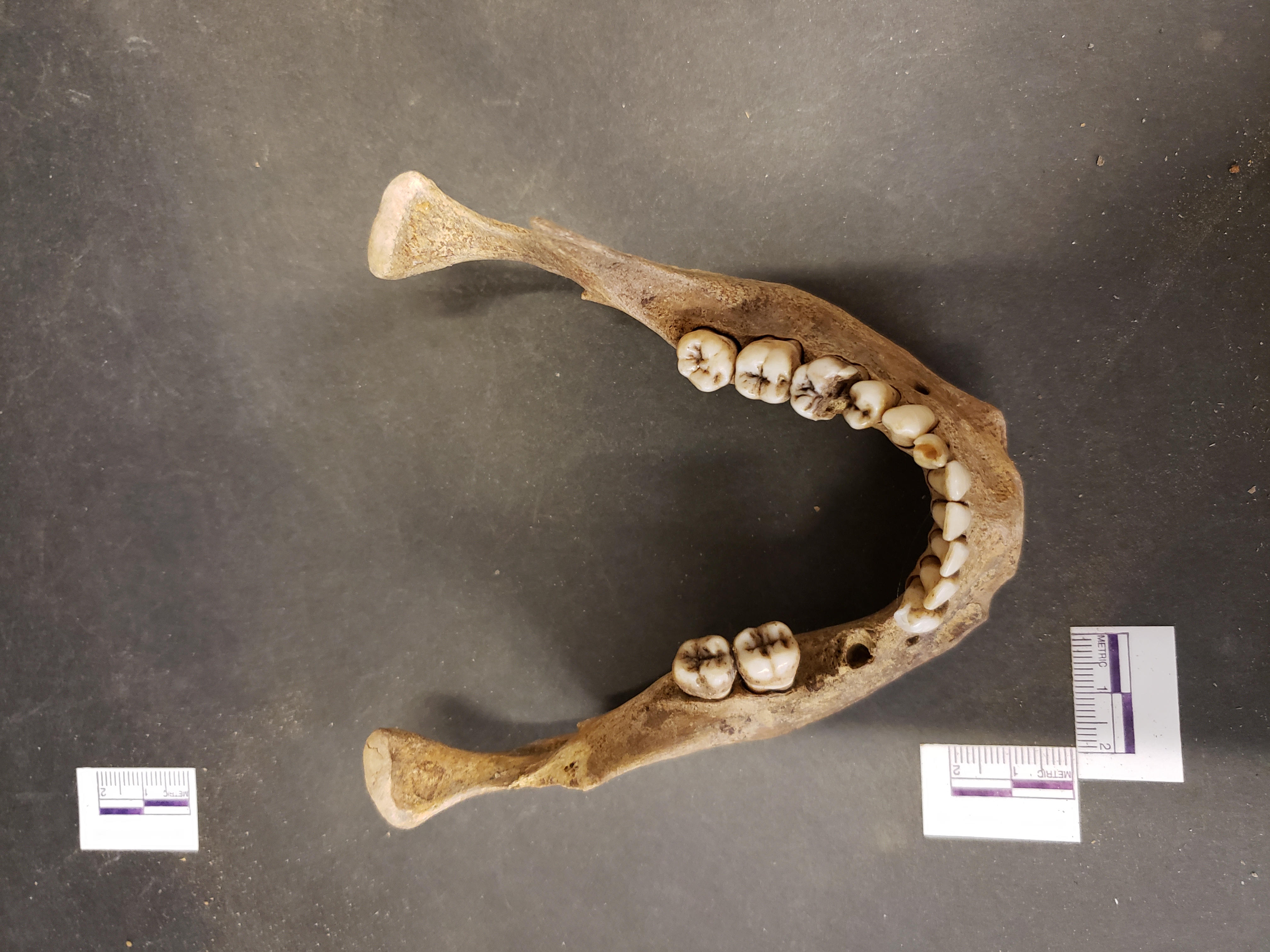 Superior view (posterior up)