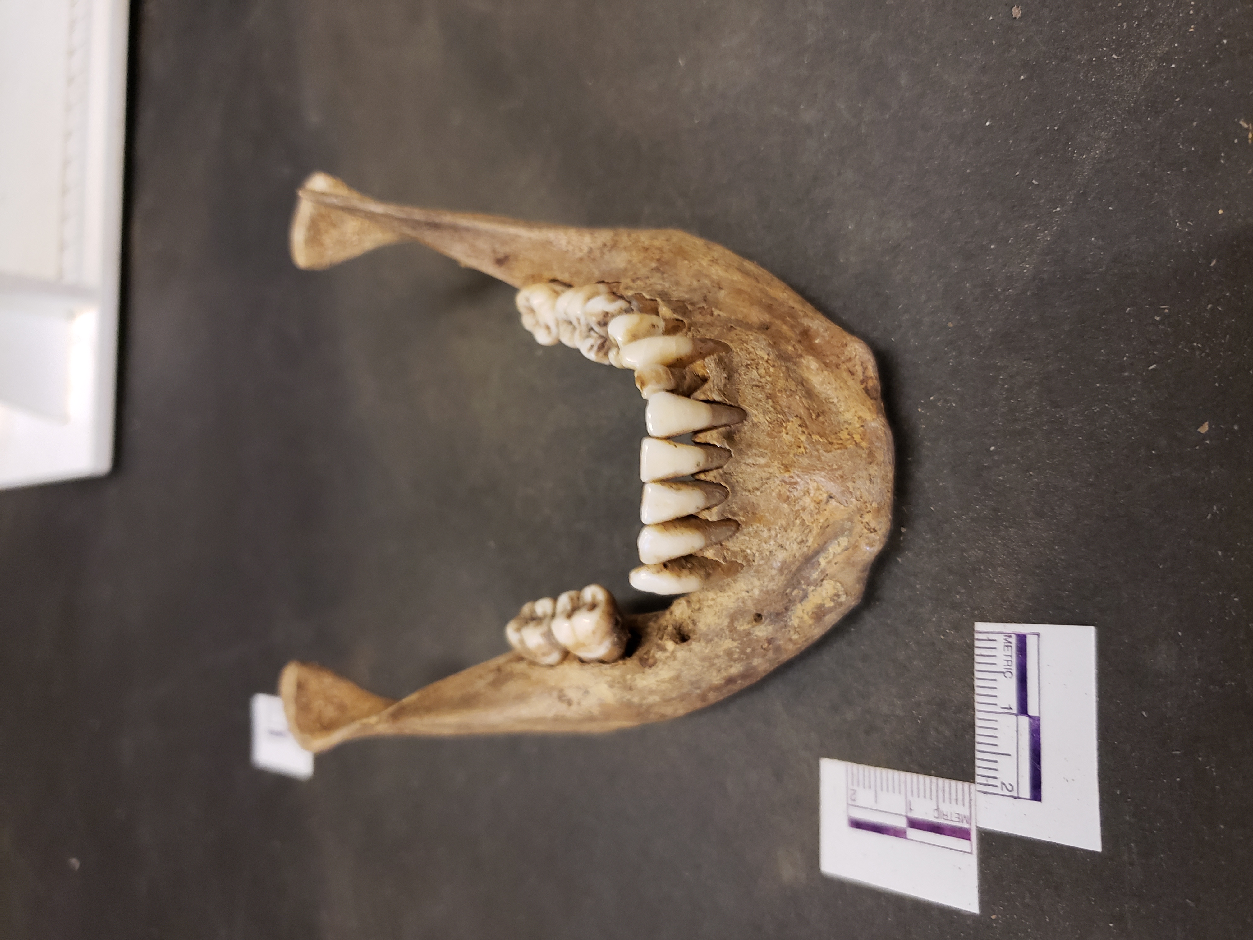 Anterior view