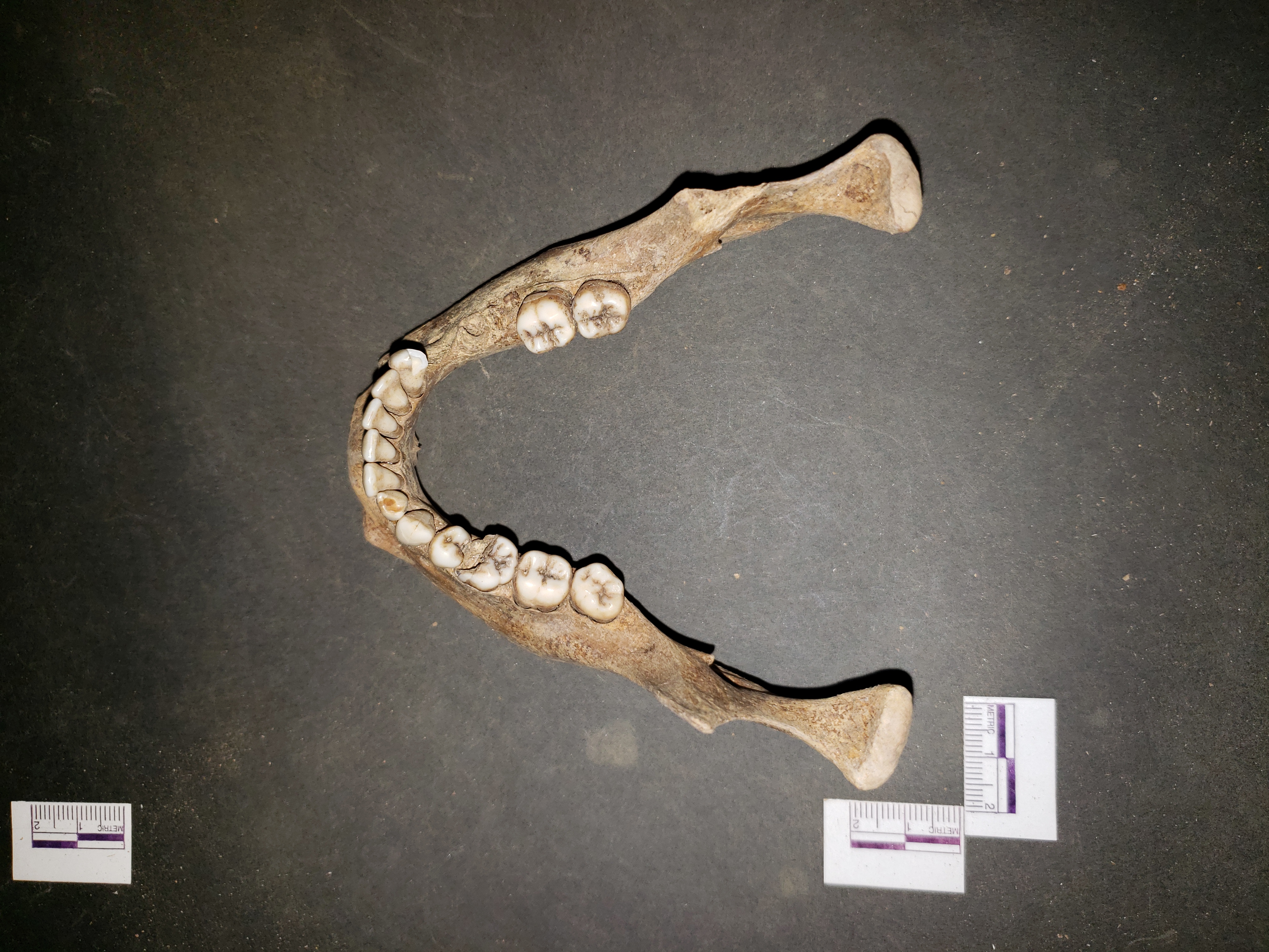 Superior view (posterior down)