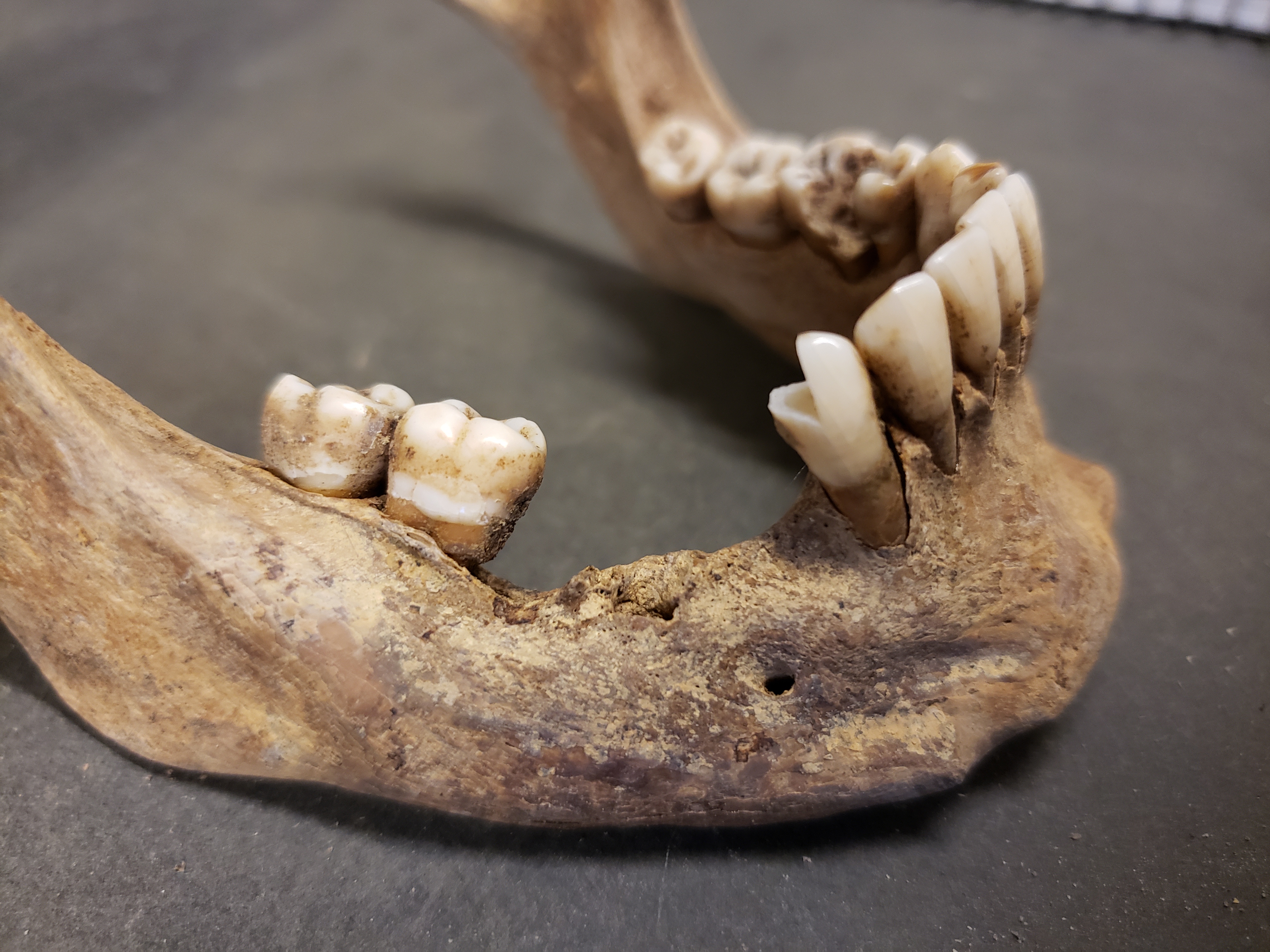 Close-up of gap in teeth