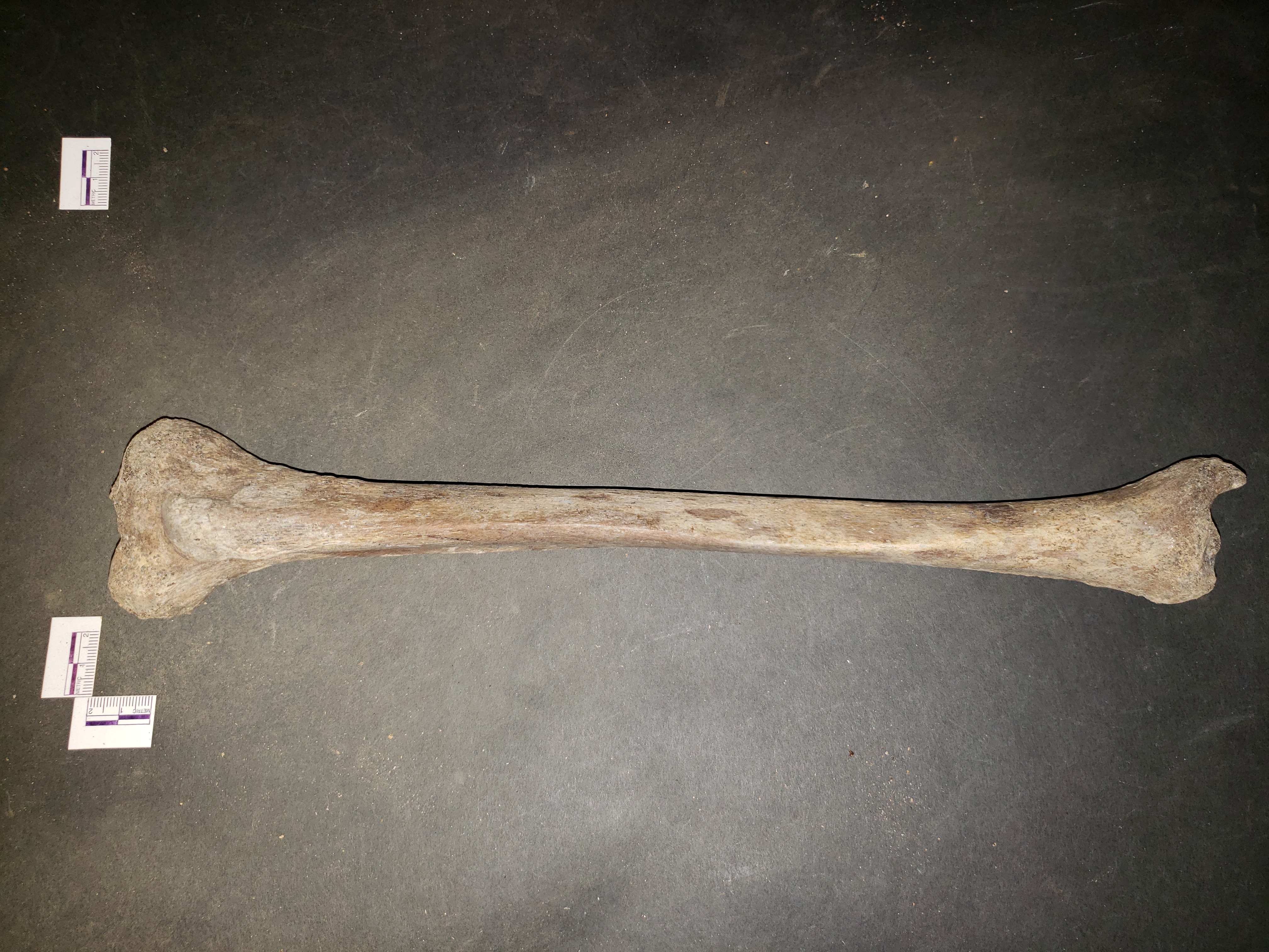 Anterior view (distal down)