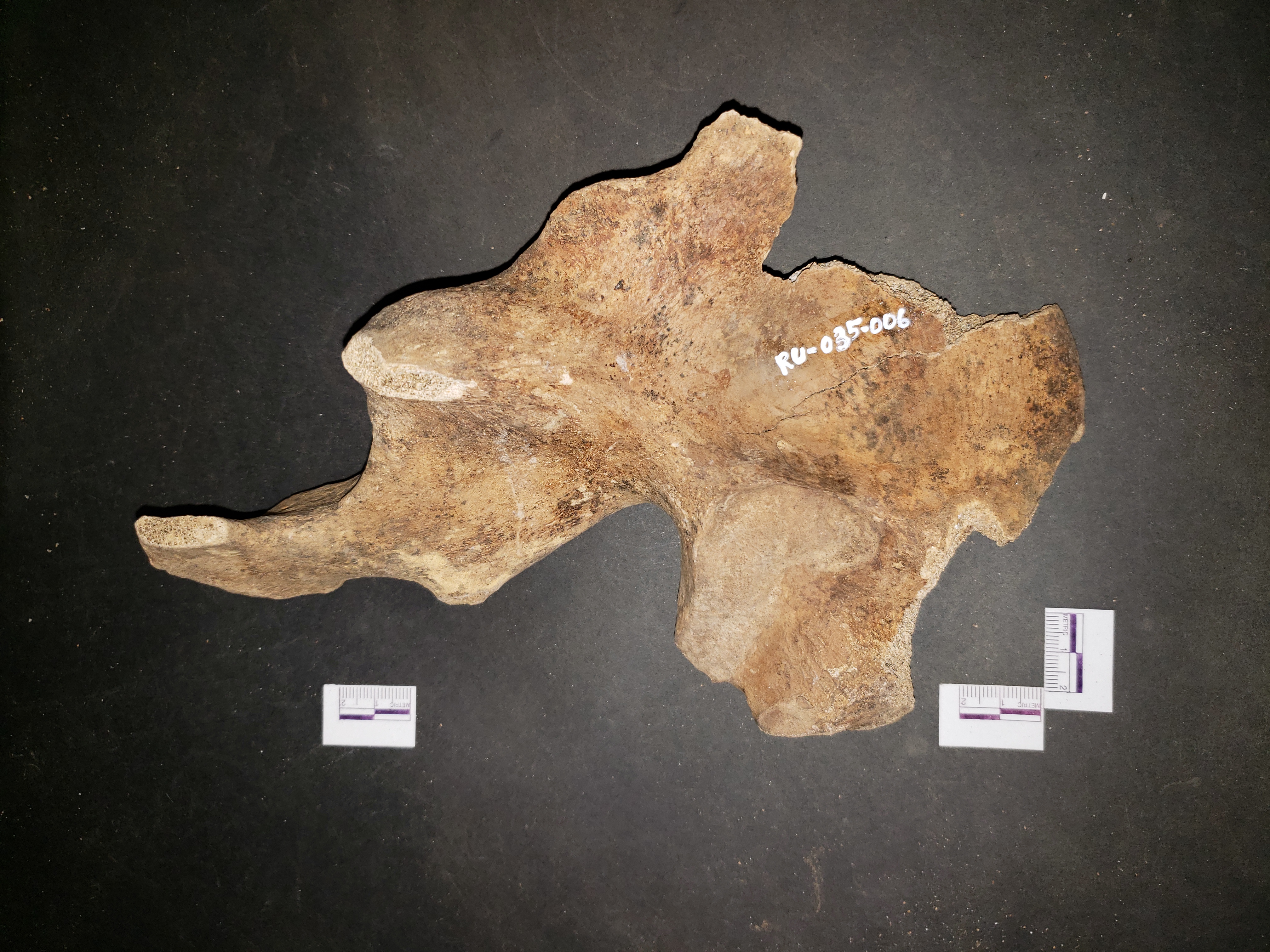 Posterior view (superior down)