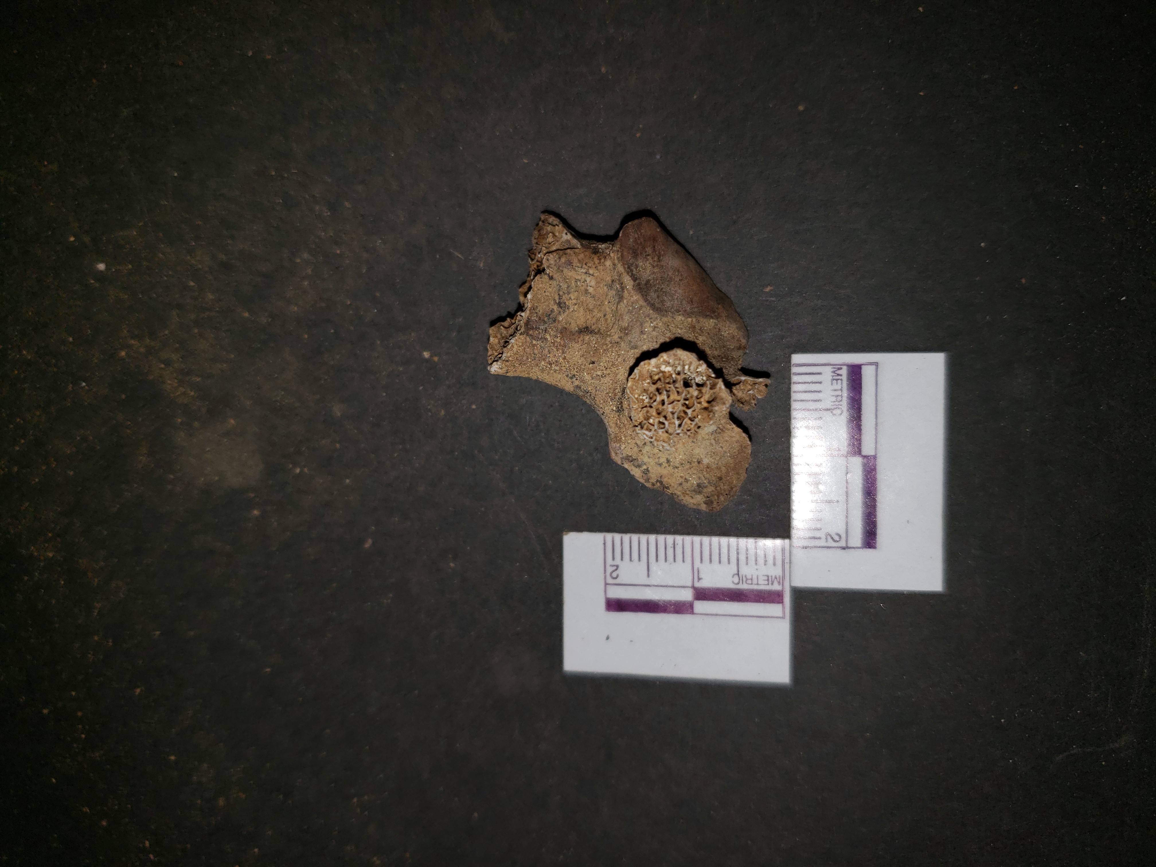 Anterior view