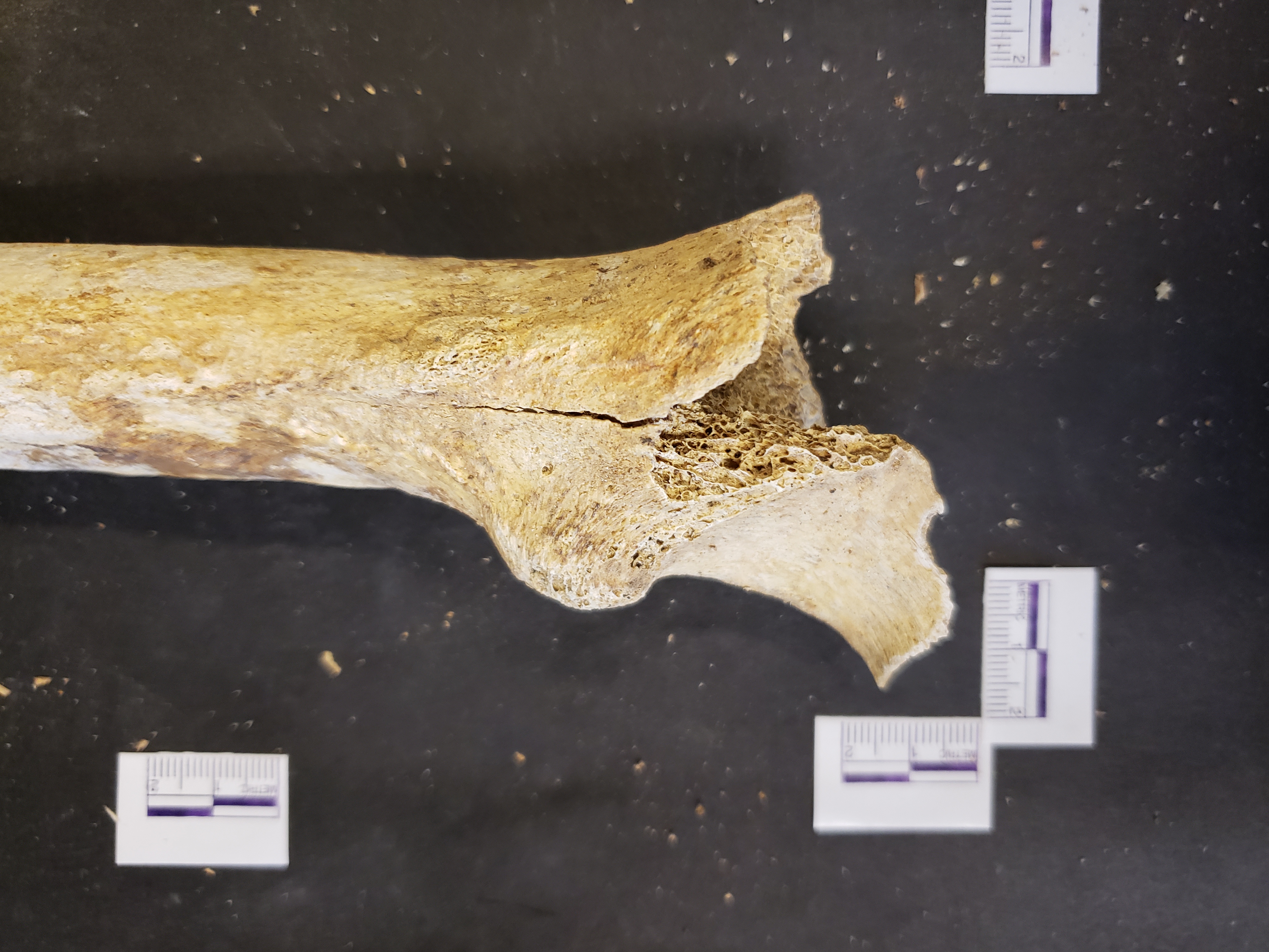 Proximal end (posterior)