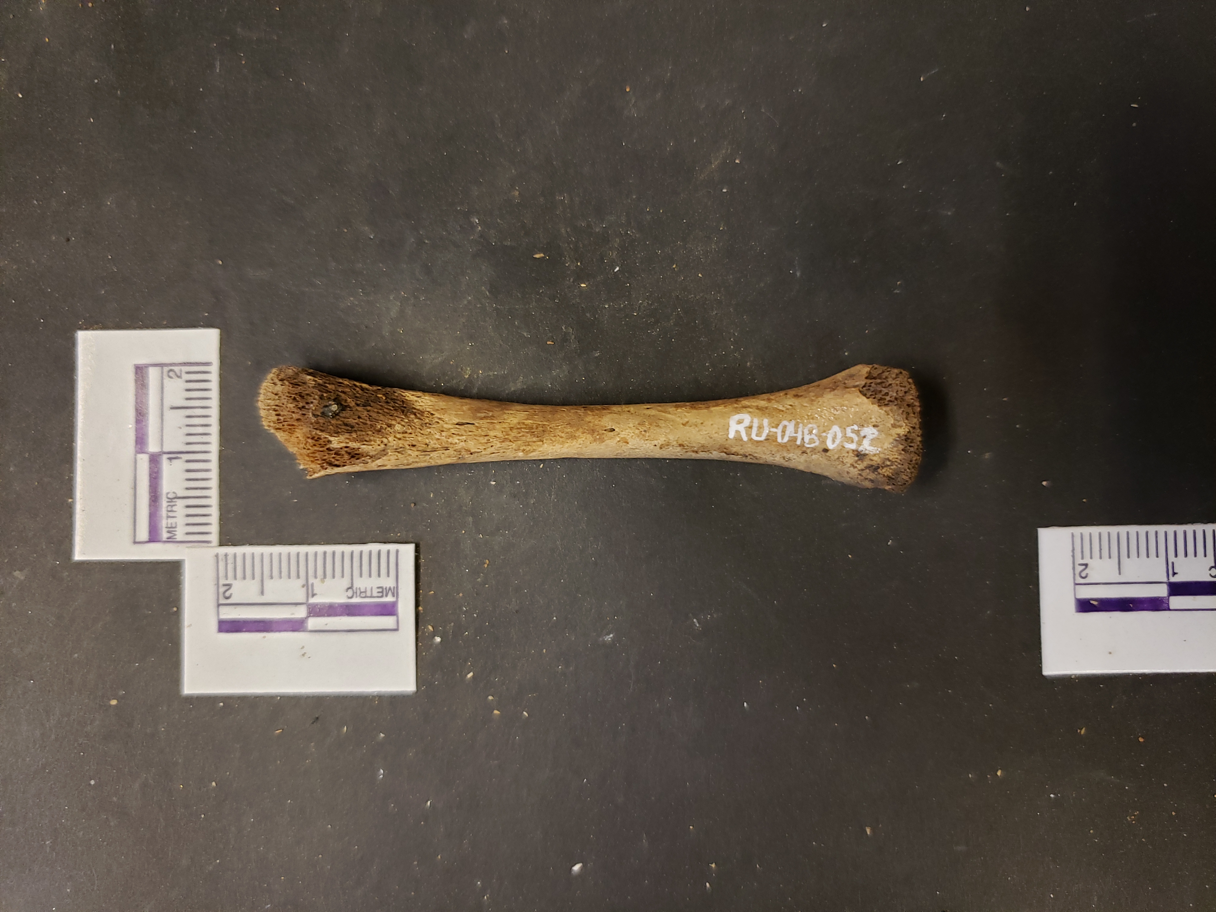 Anterior view (distal down)
