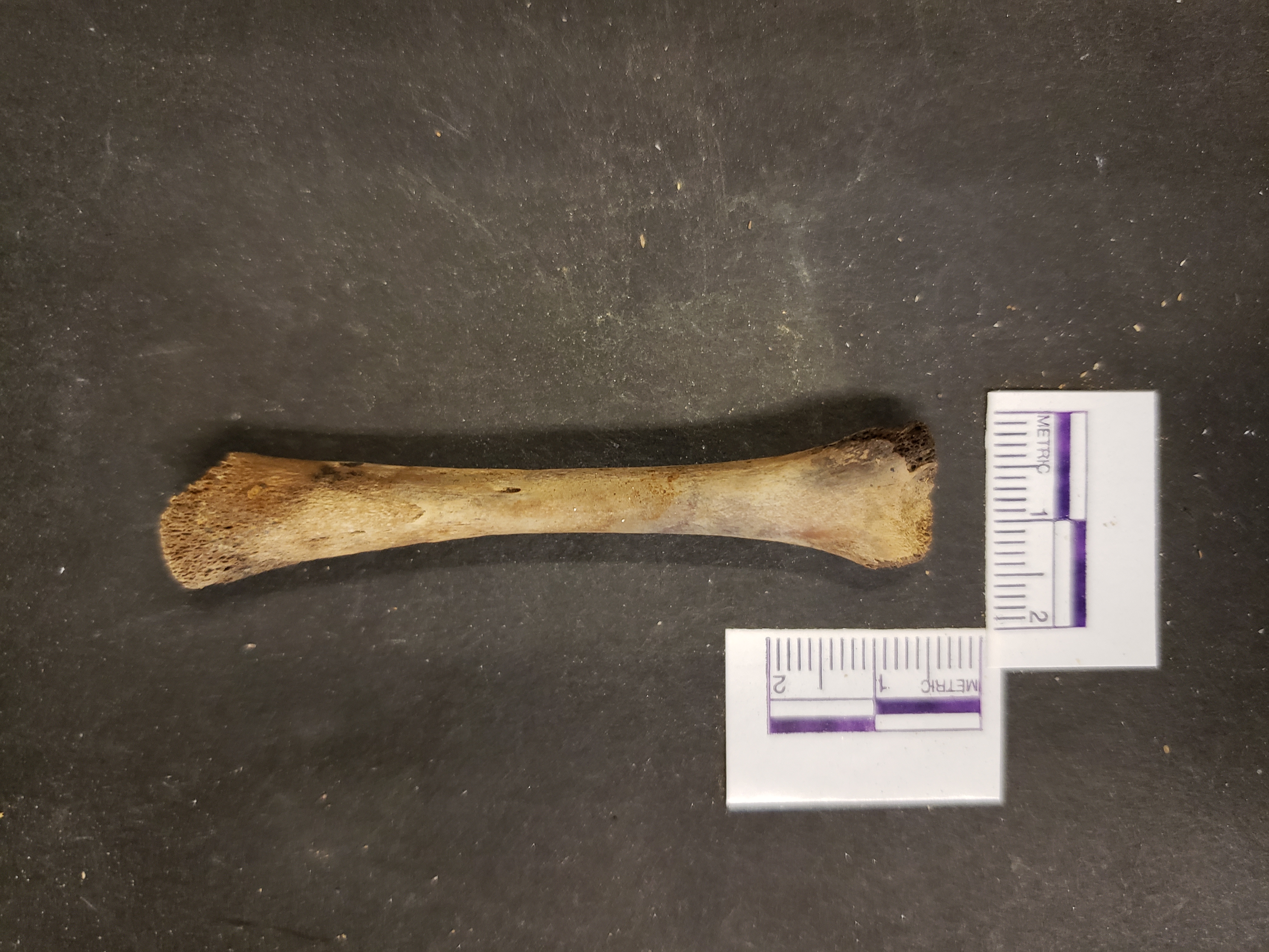 Posterior view (distal down)