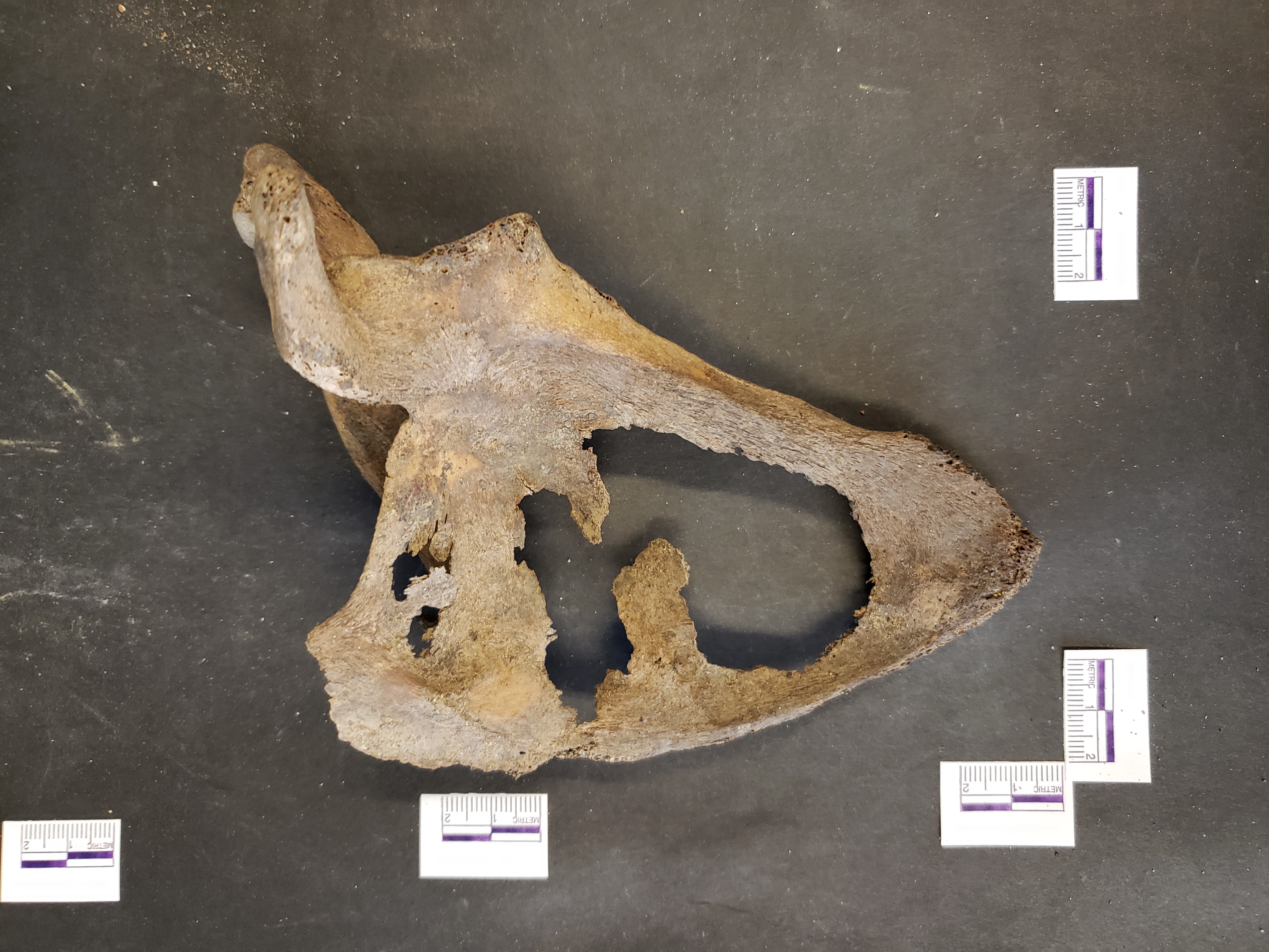 Anterior view