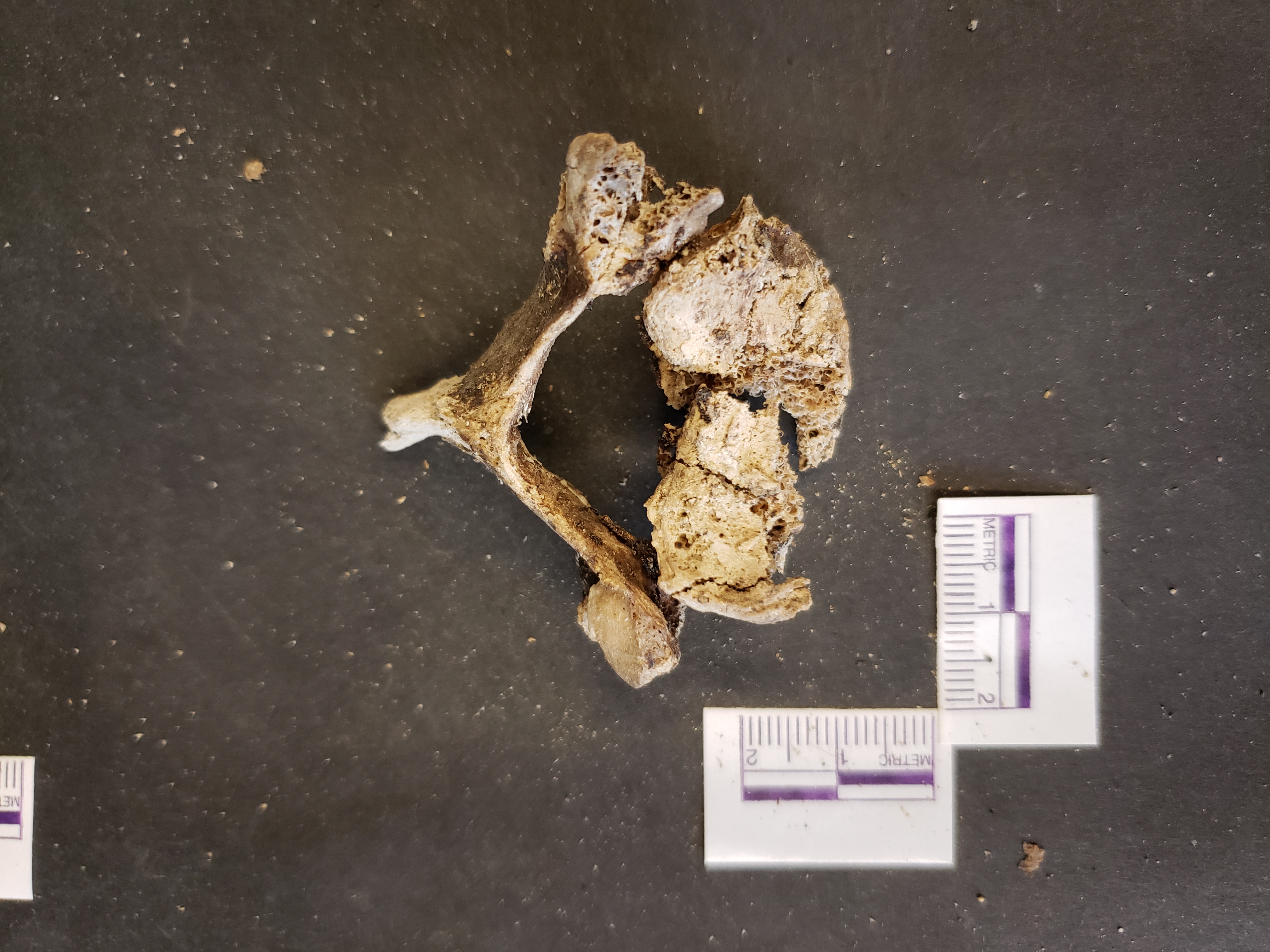 Superior view (anterior down)