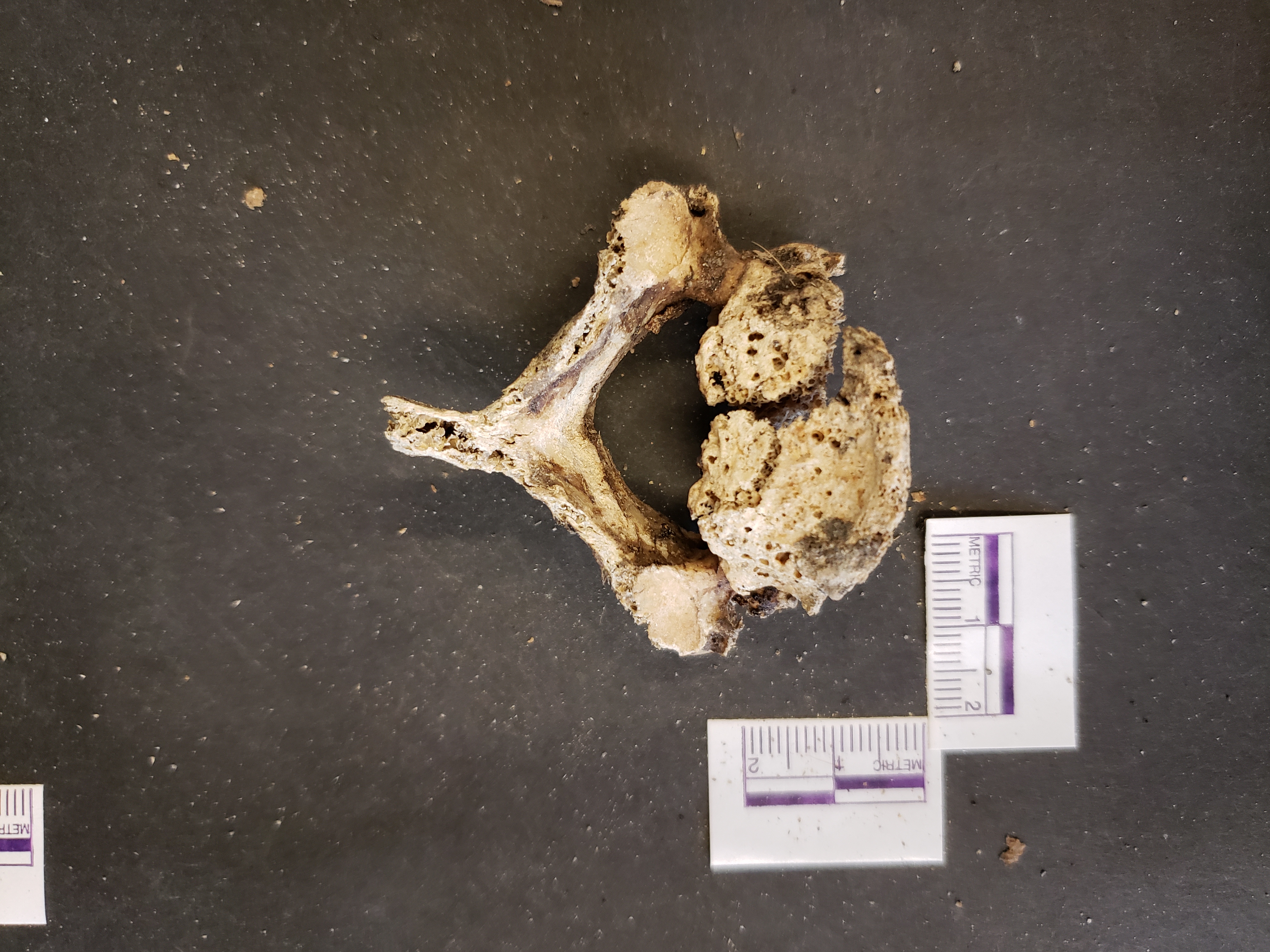 Inferior view (anterior down)
