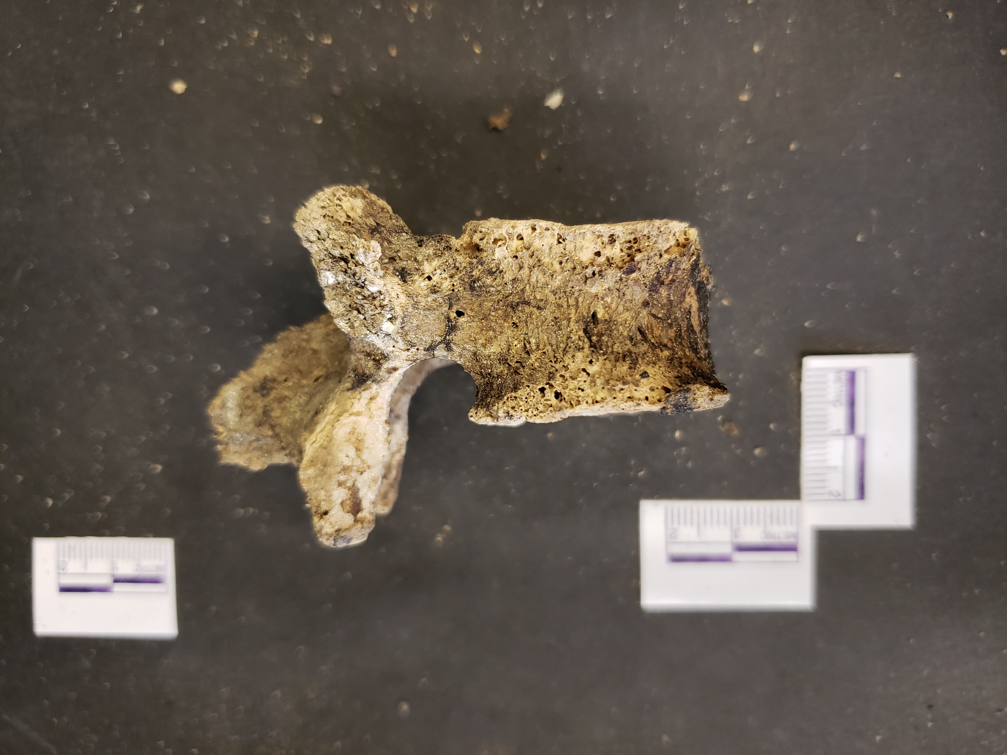 Lateral view (superior right)