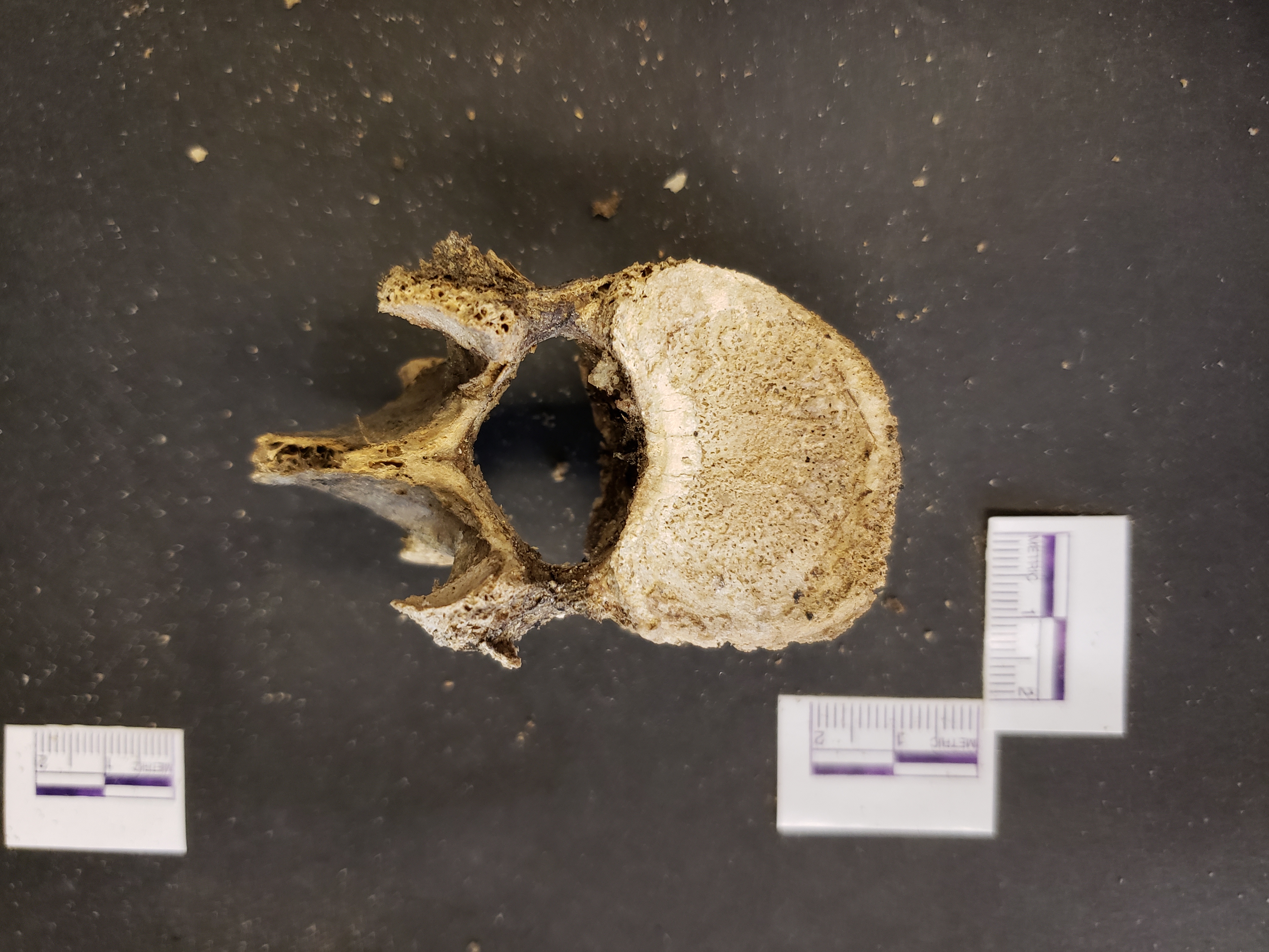 Superior view (anterior down)