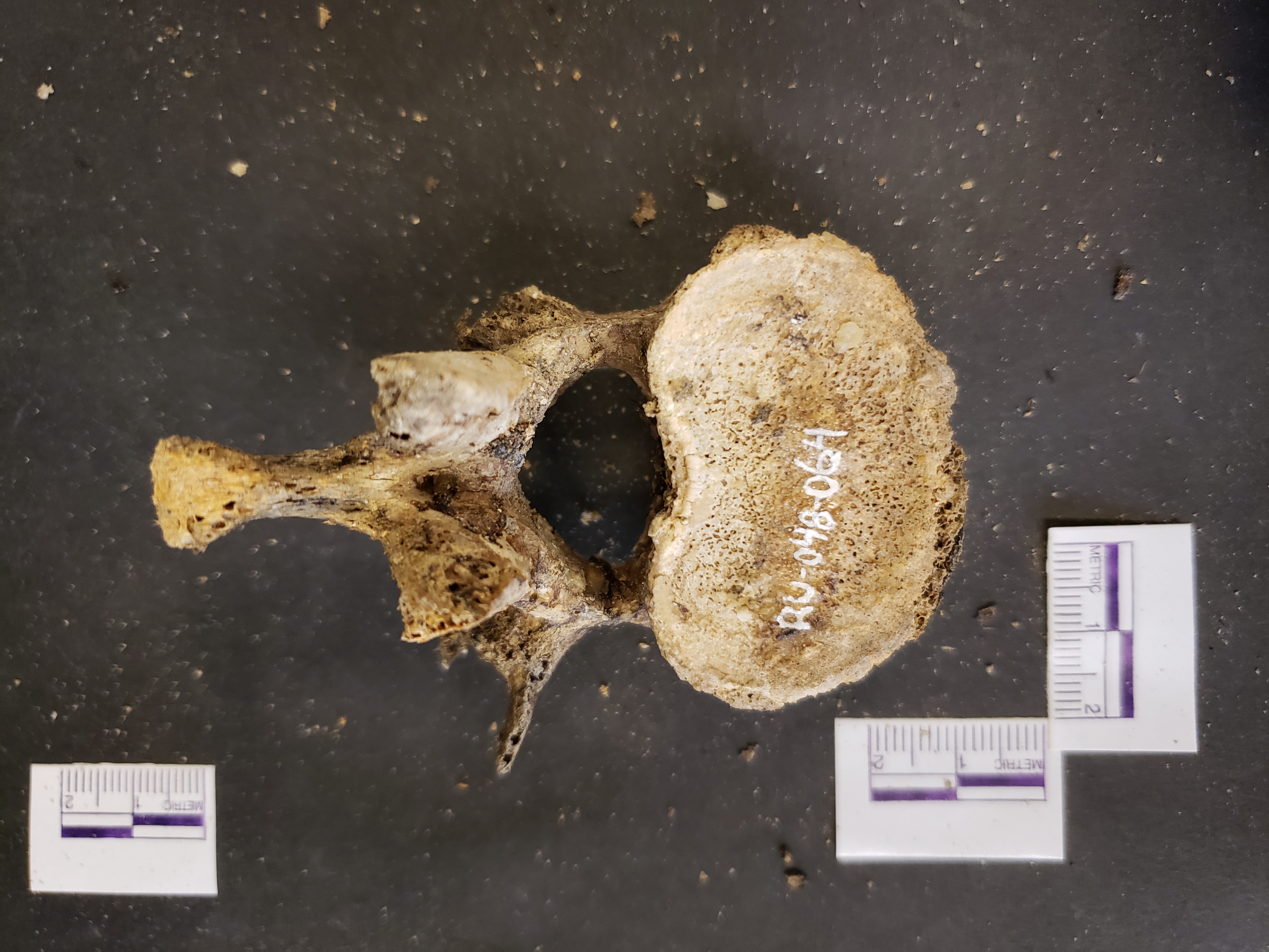 Inferior view (anterior down)