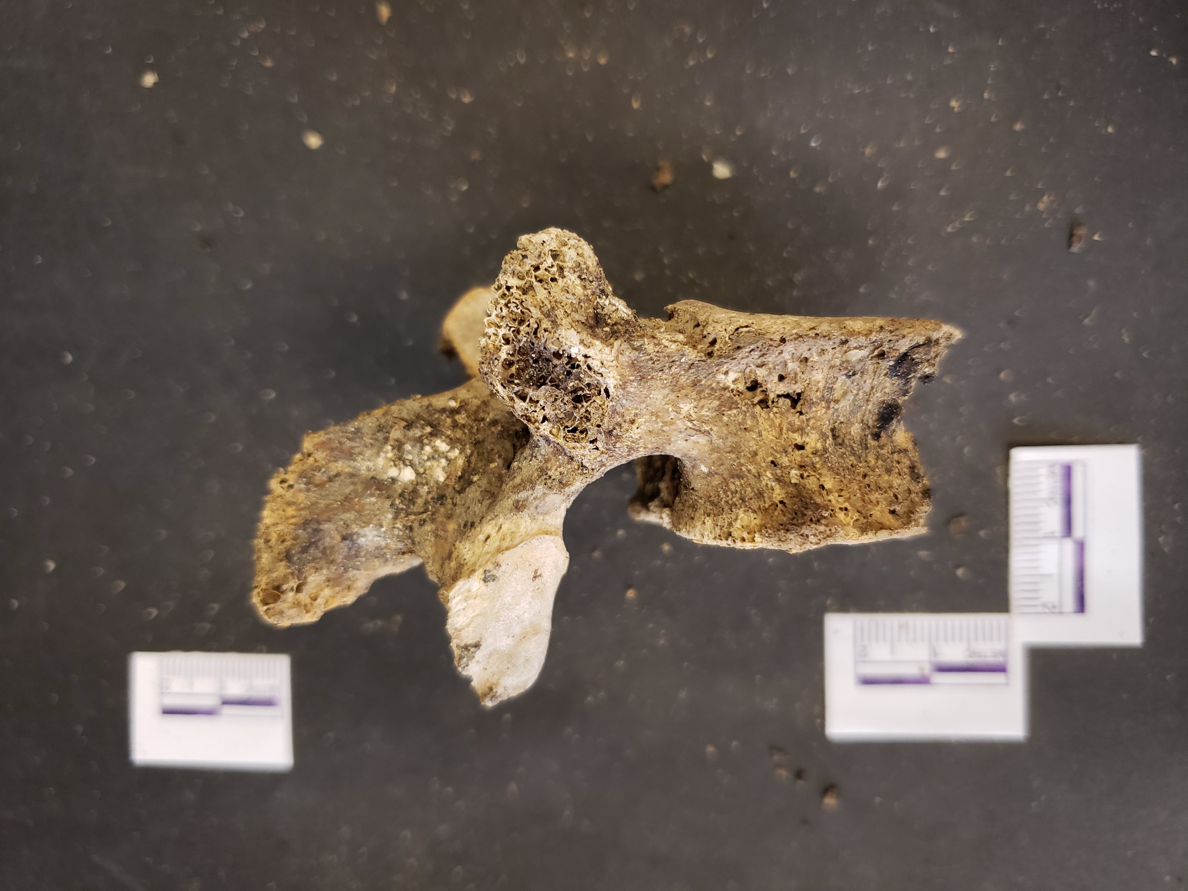Lateral view (superior right)