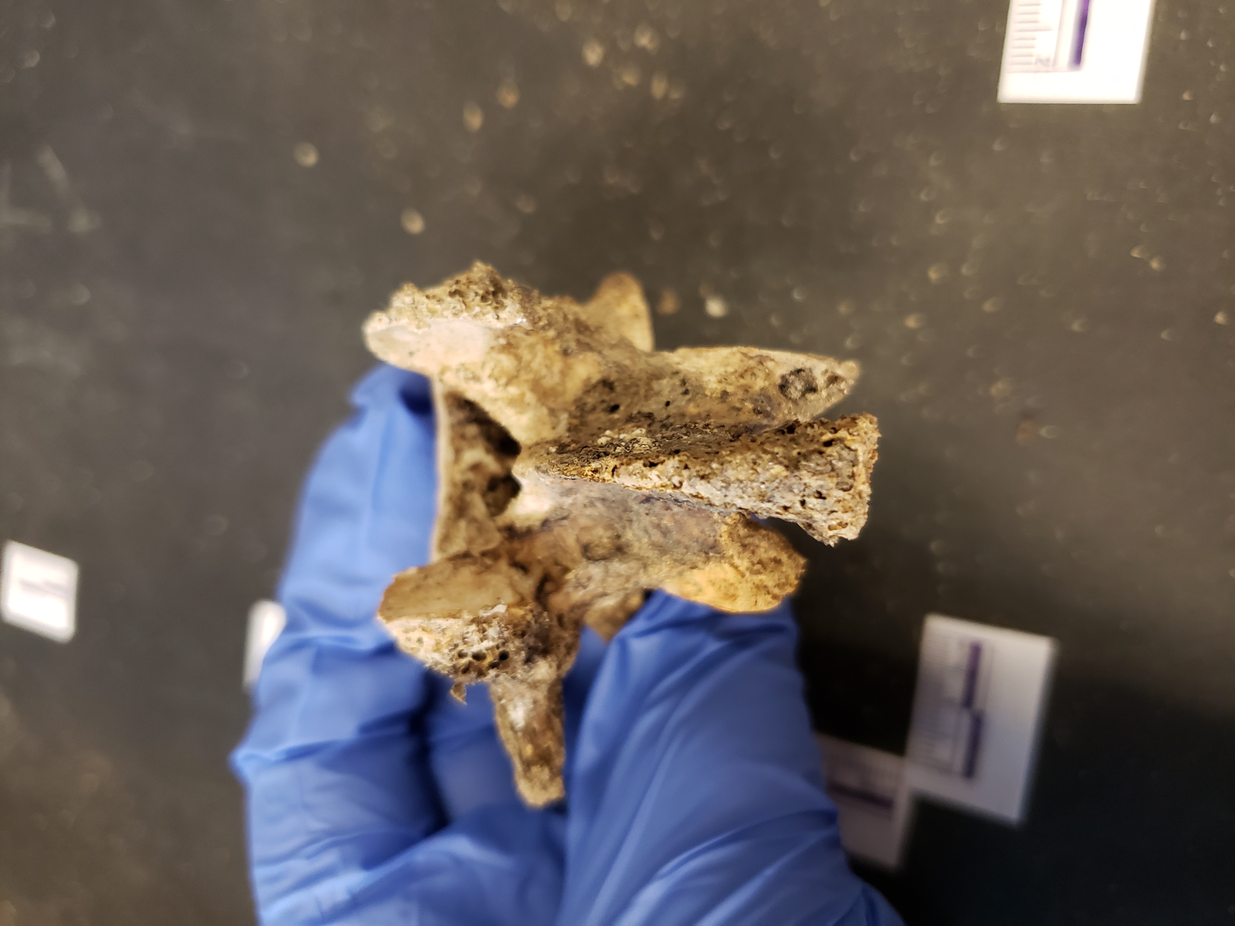 Posterior view