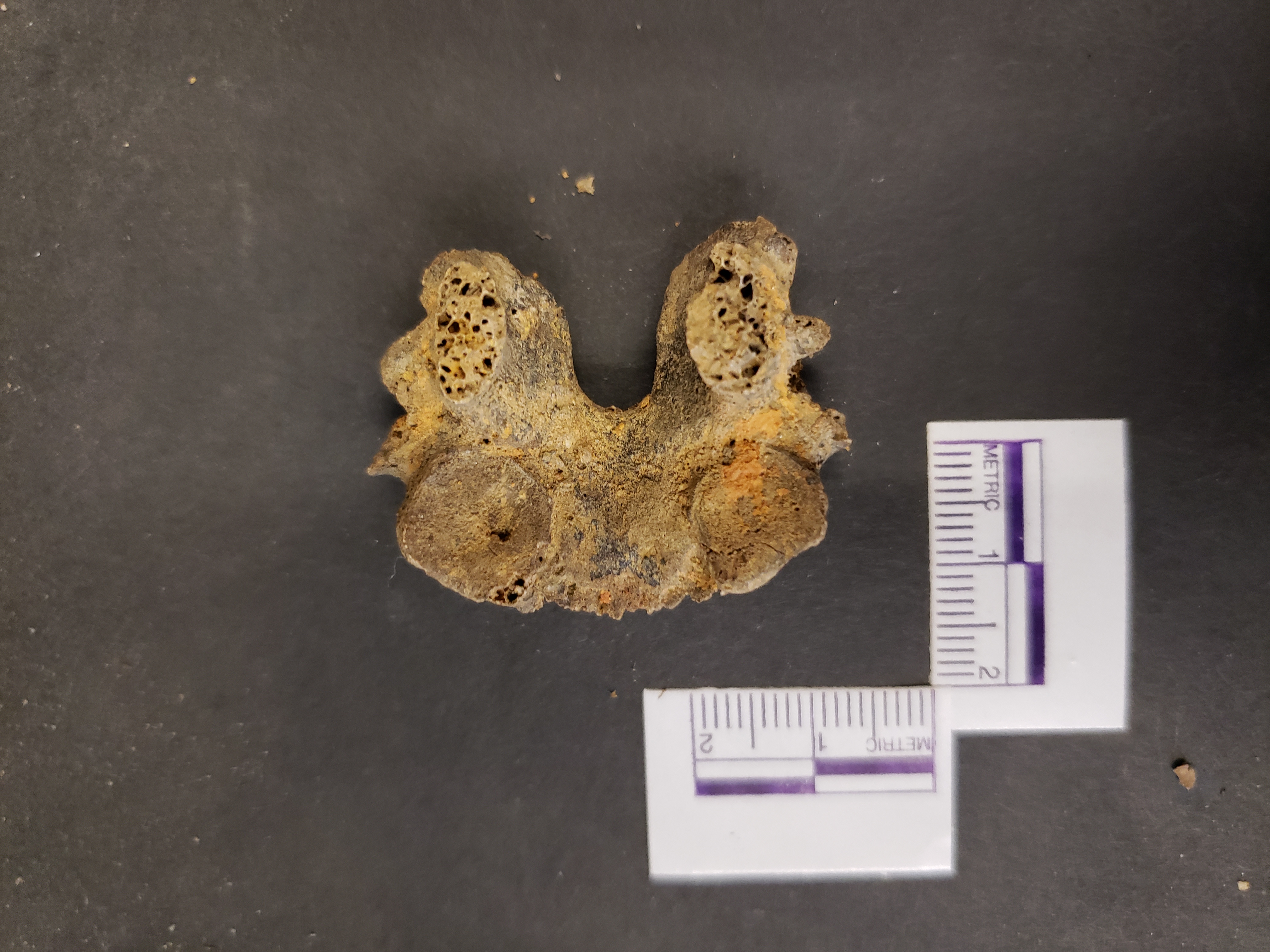 Anterior view (superior right)