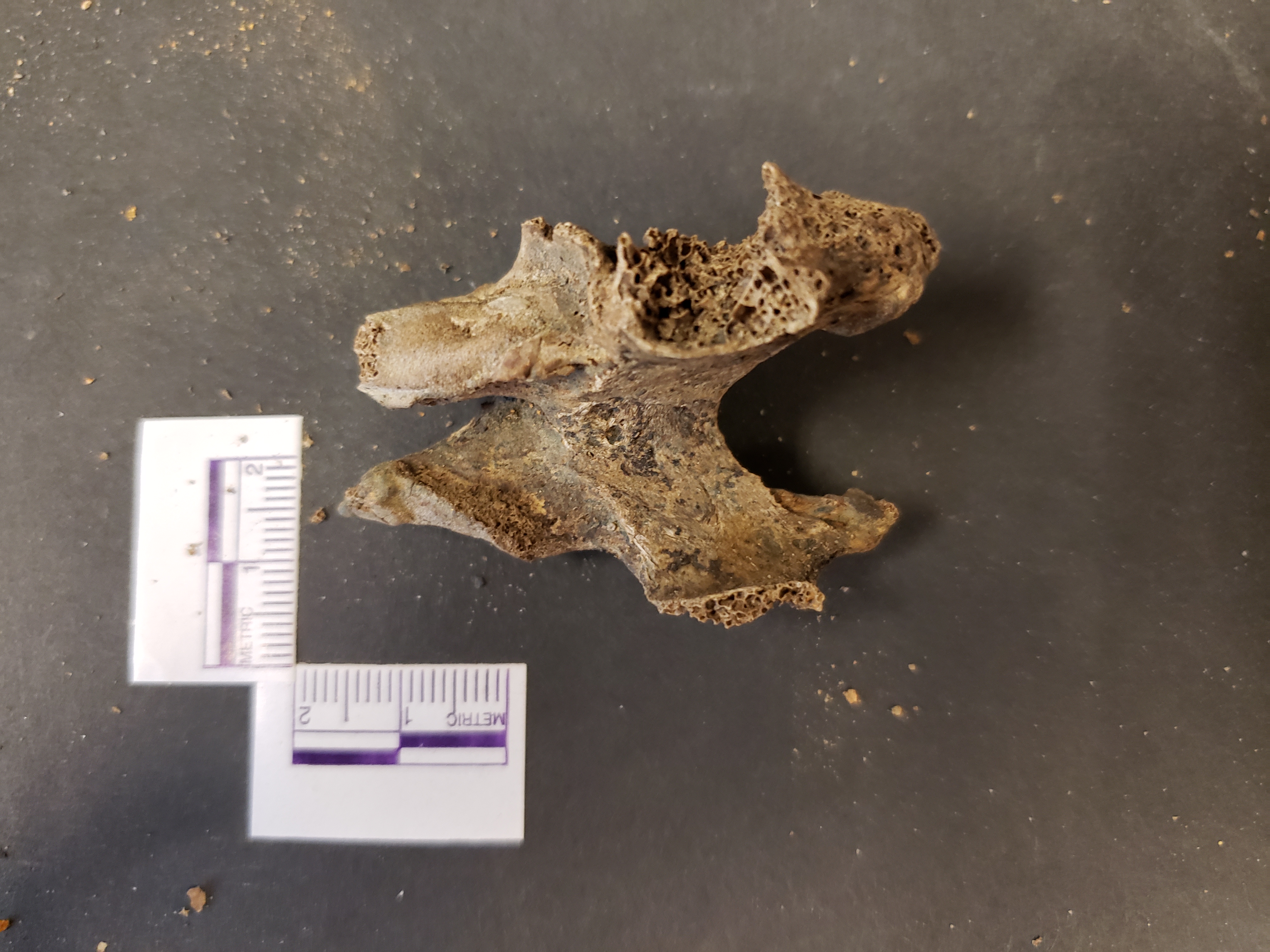 Anterior view (superior down)
