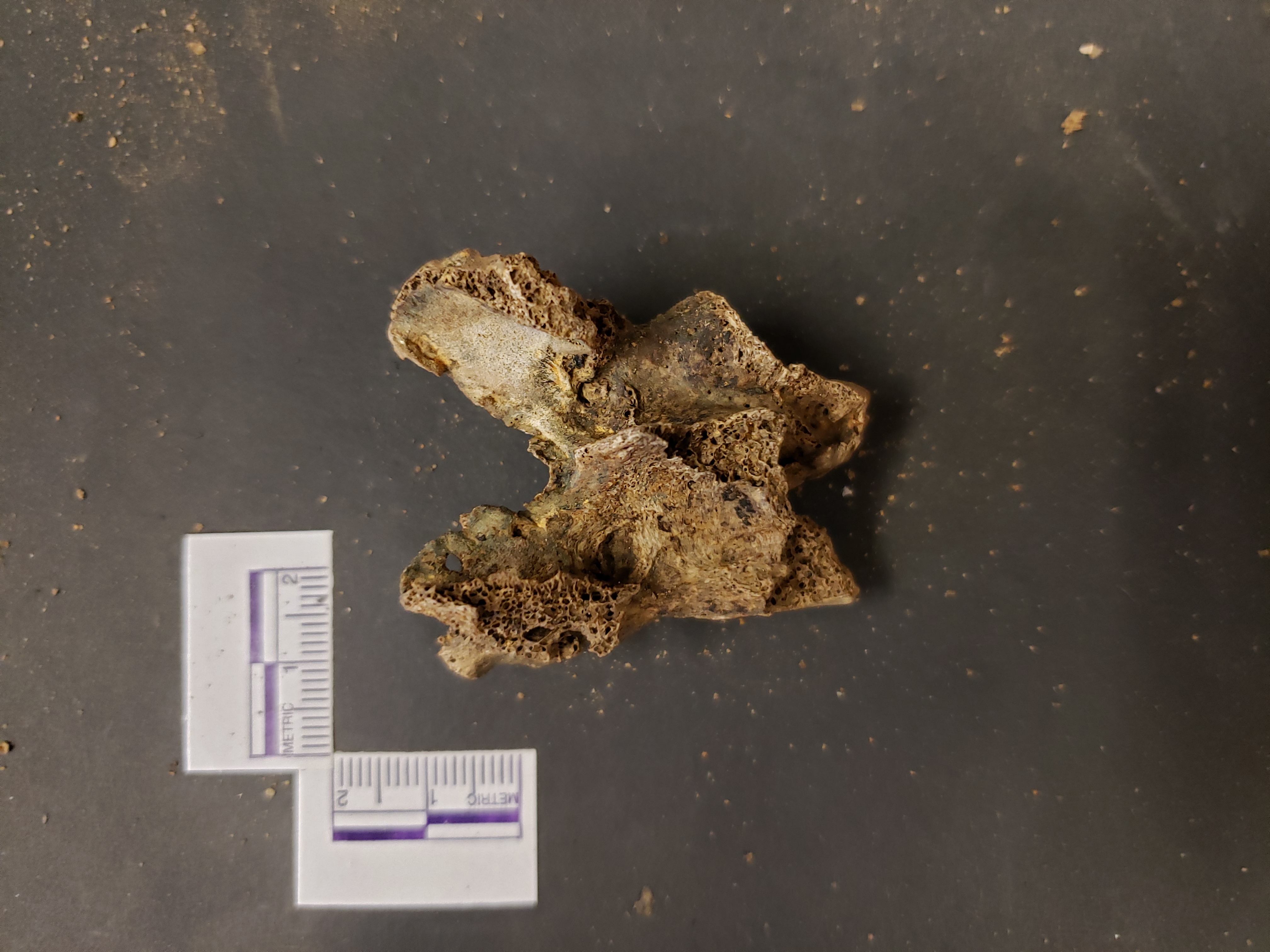 Posterior view (superior up)