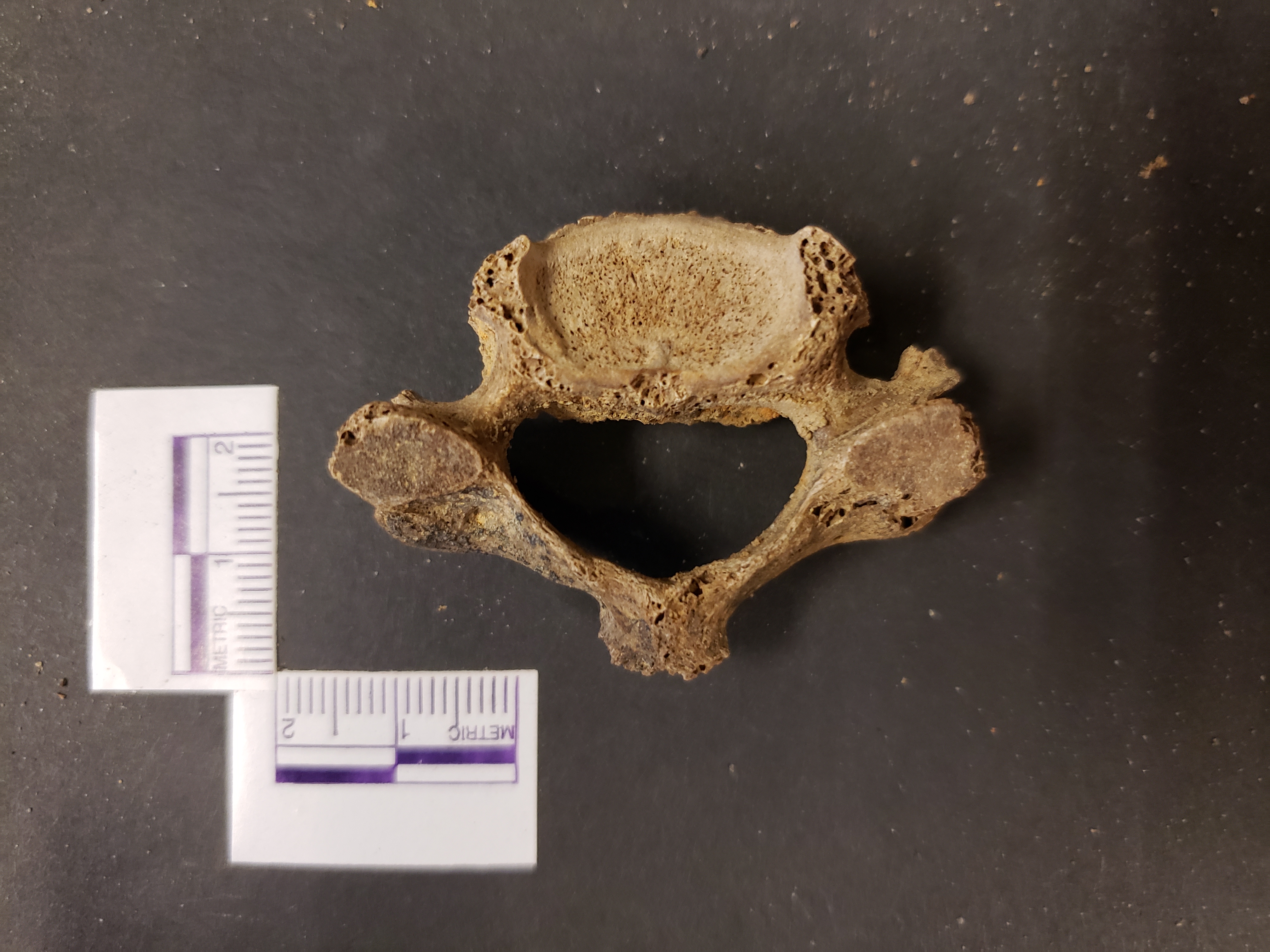 Superior view (anterior right)