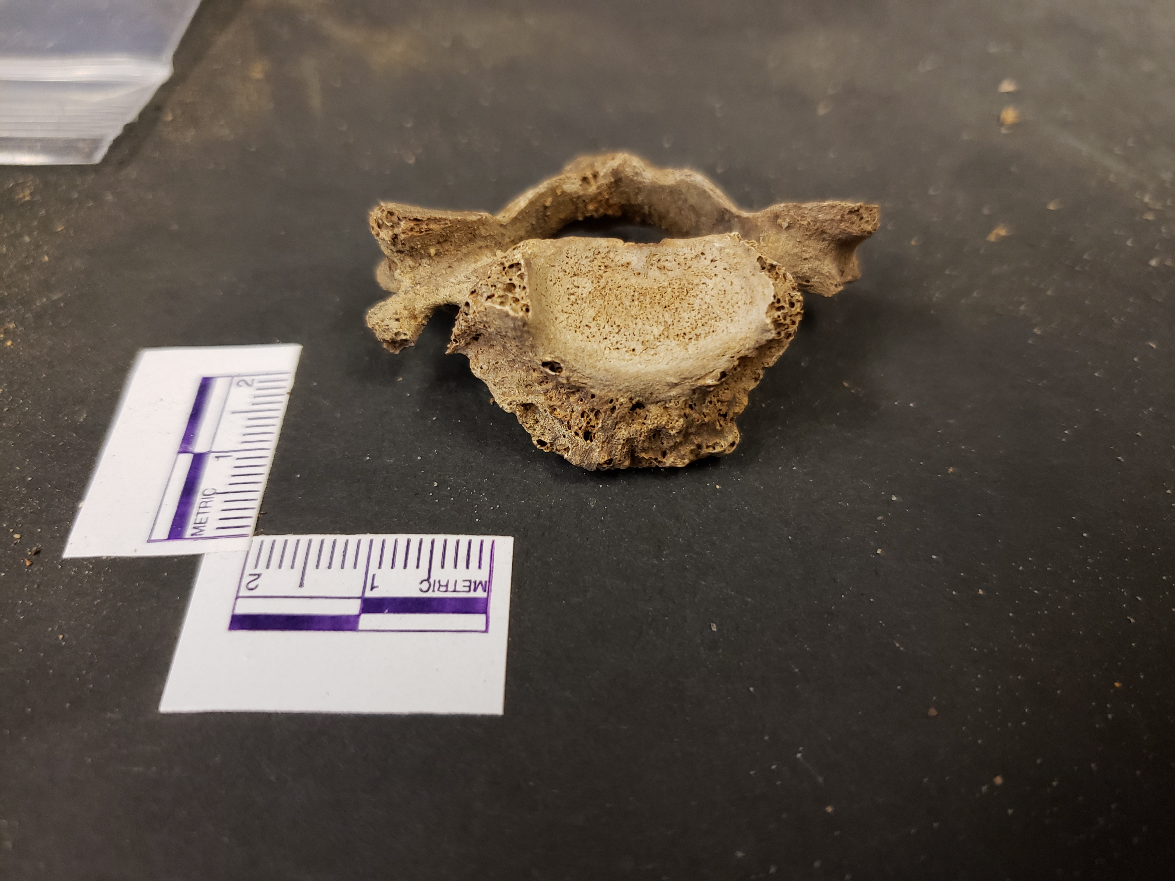 Anterior view