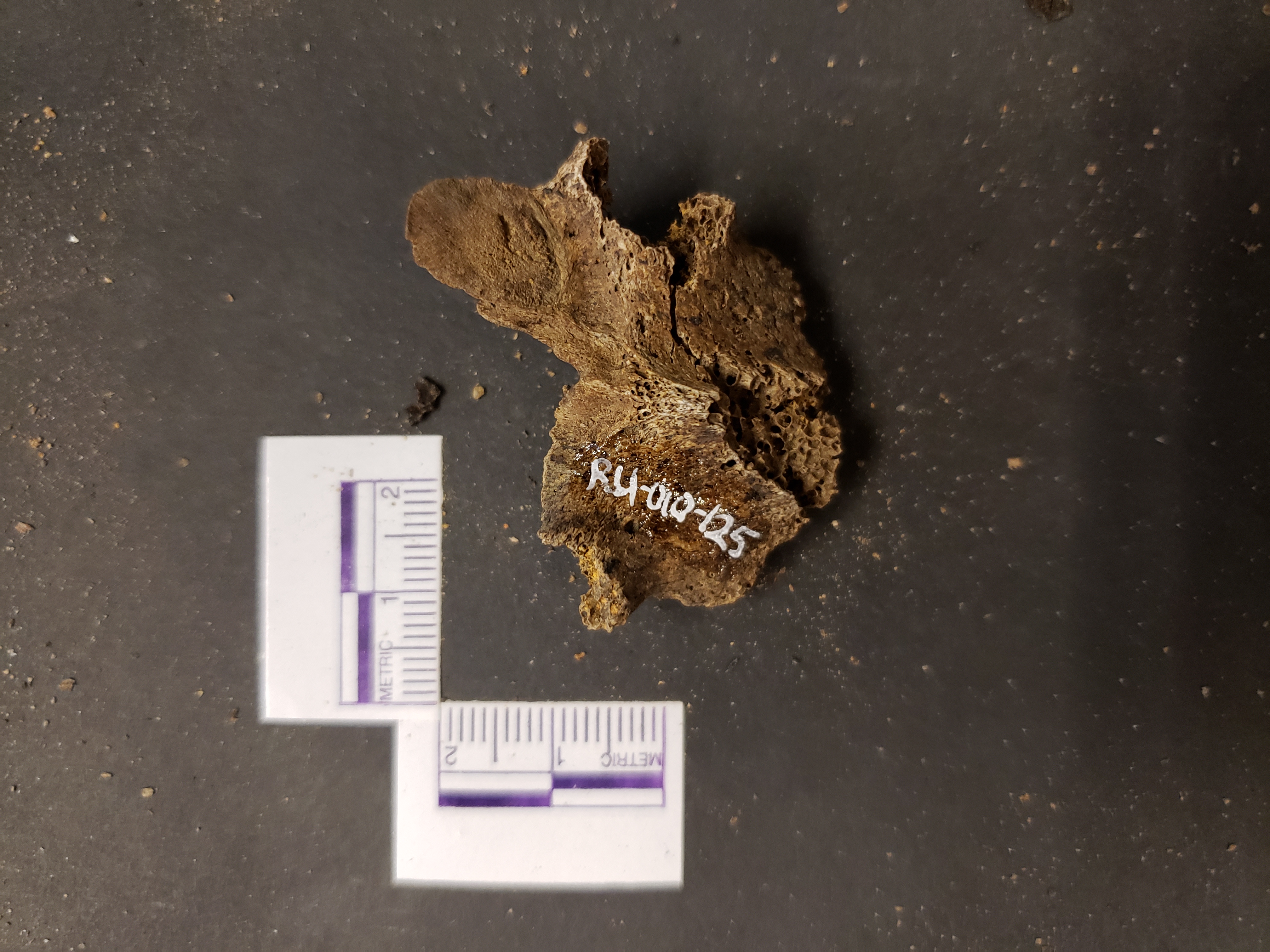 Posterior view