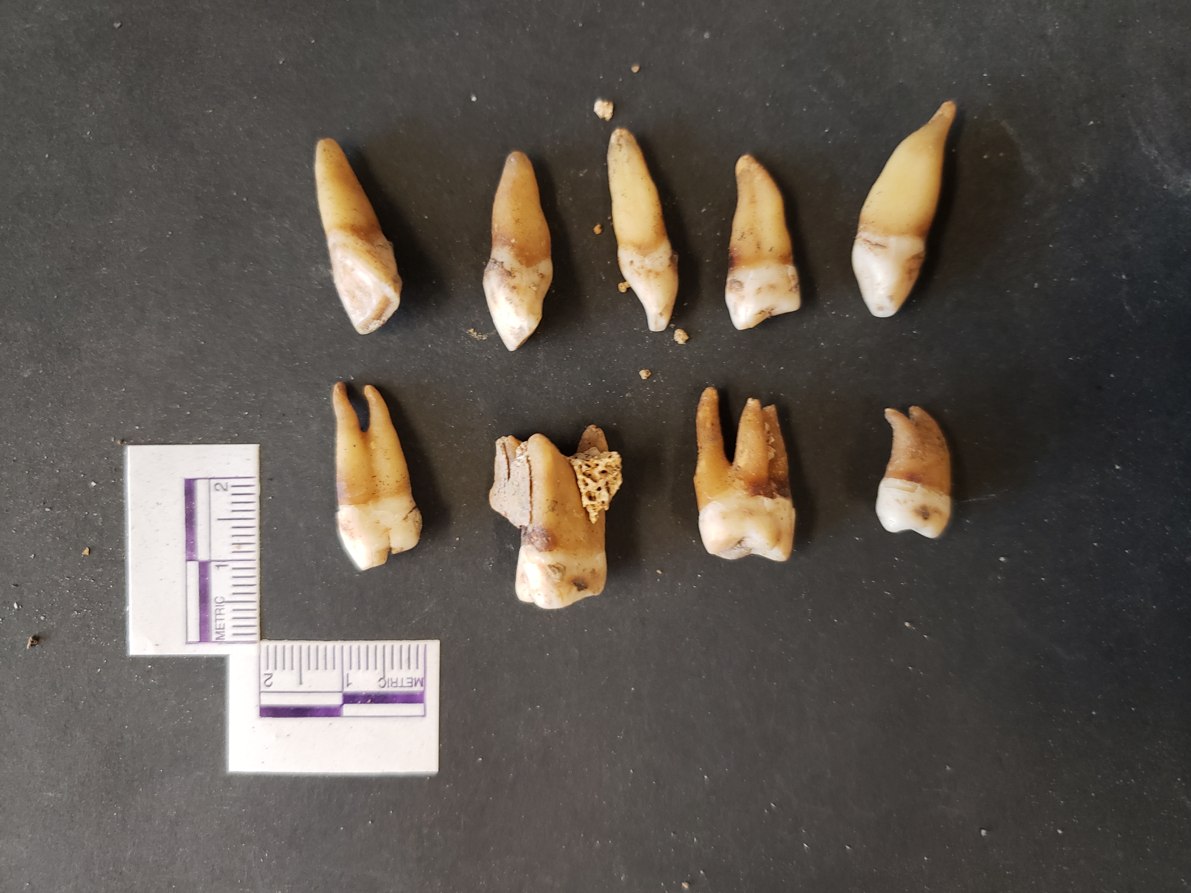 All 9 teeth