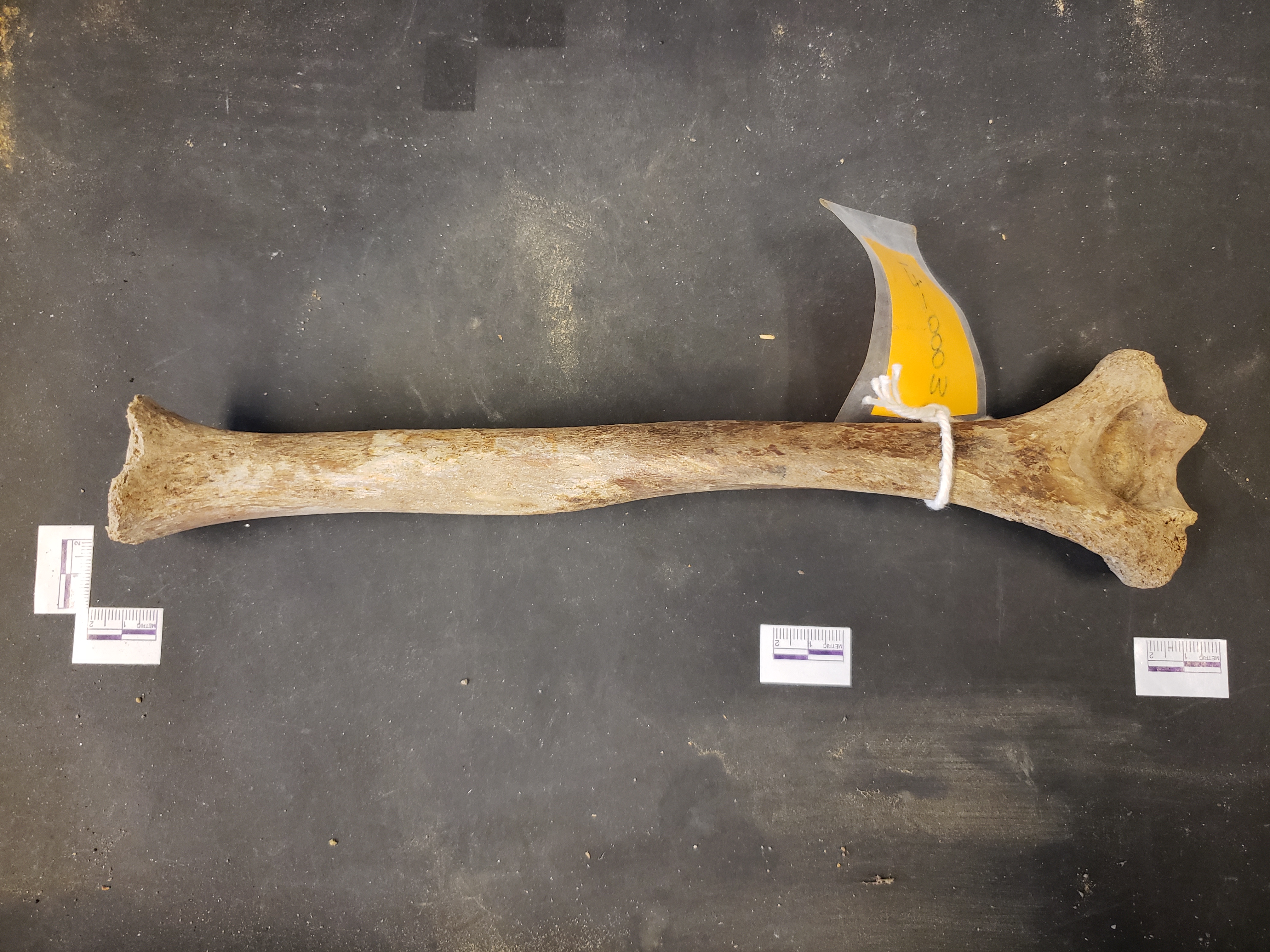 Posterior view