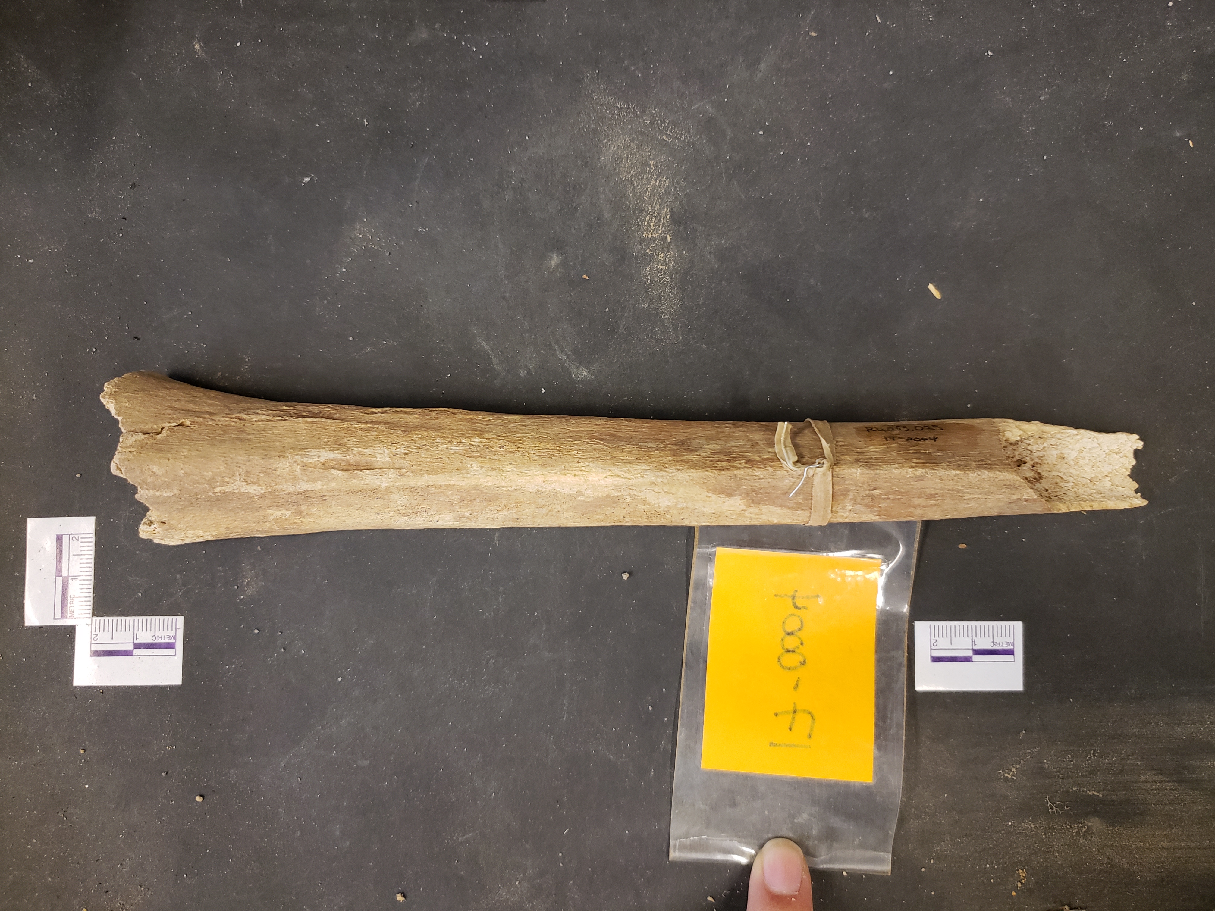 Posterior view