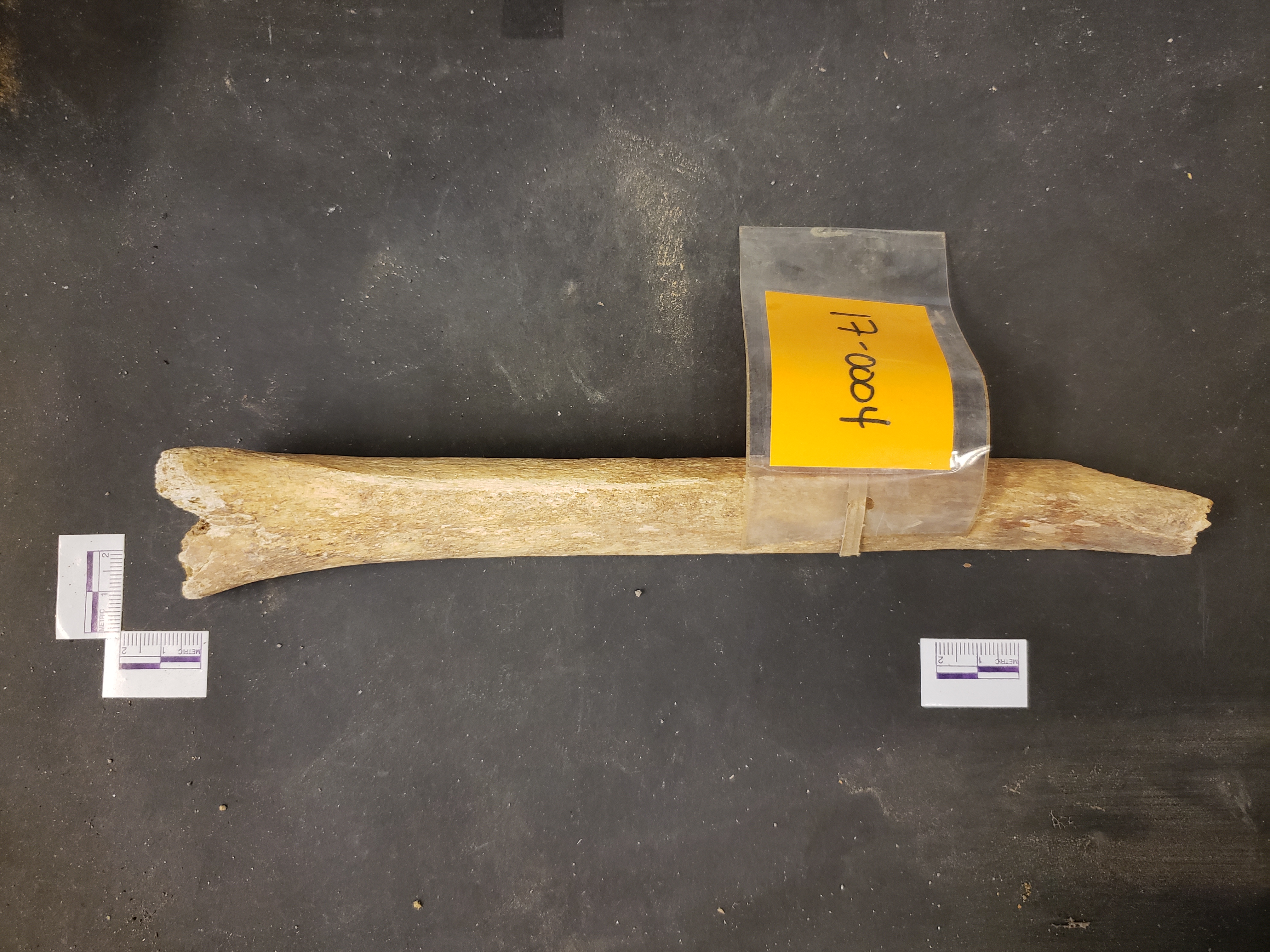 Anterior view