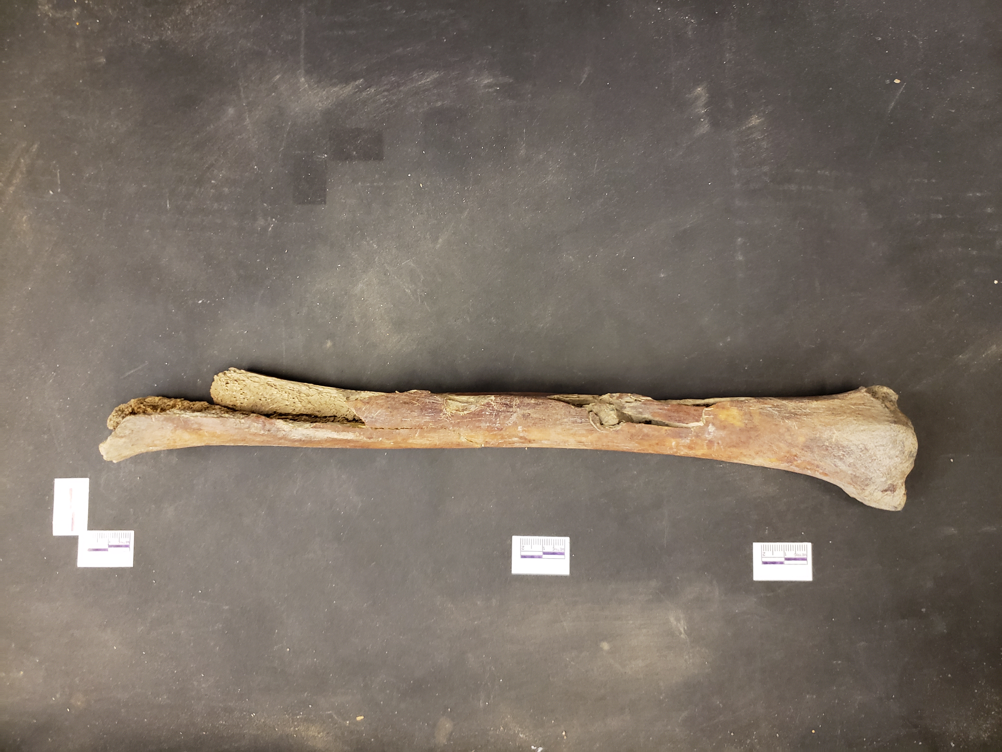 Fracture match, glued together (distal down)