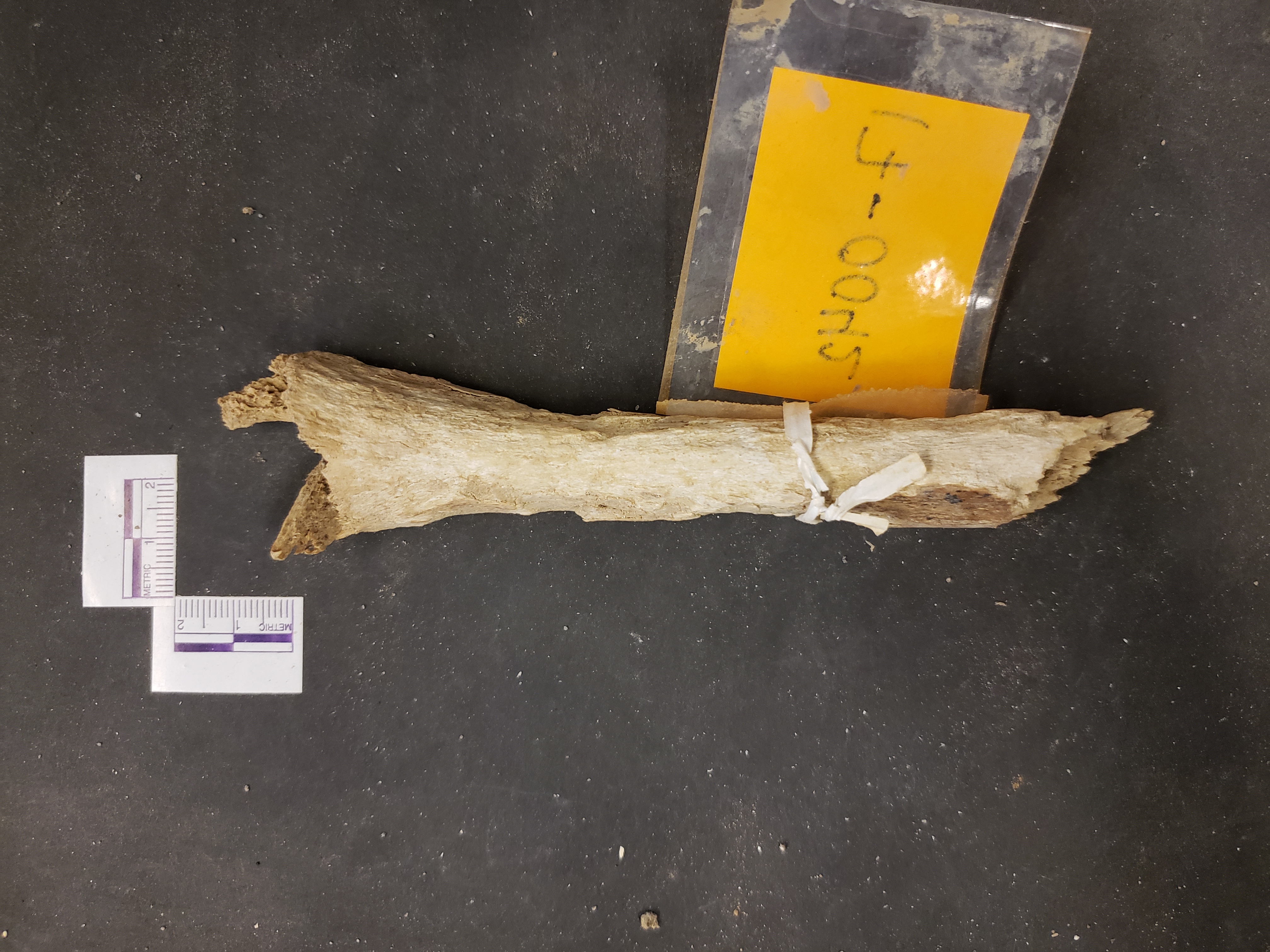Anterior view (distal up)