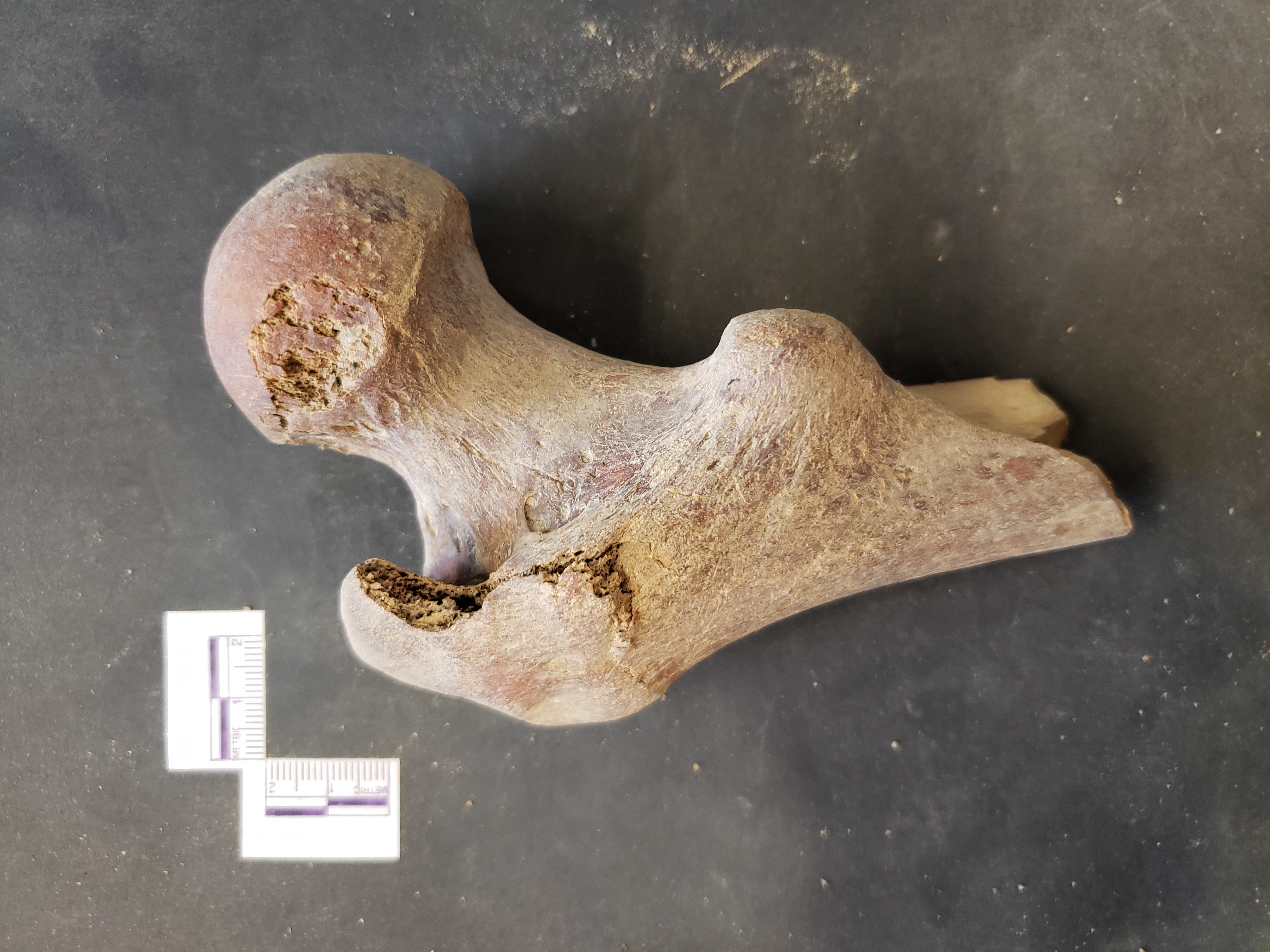 Posterior view