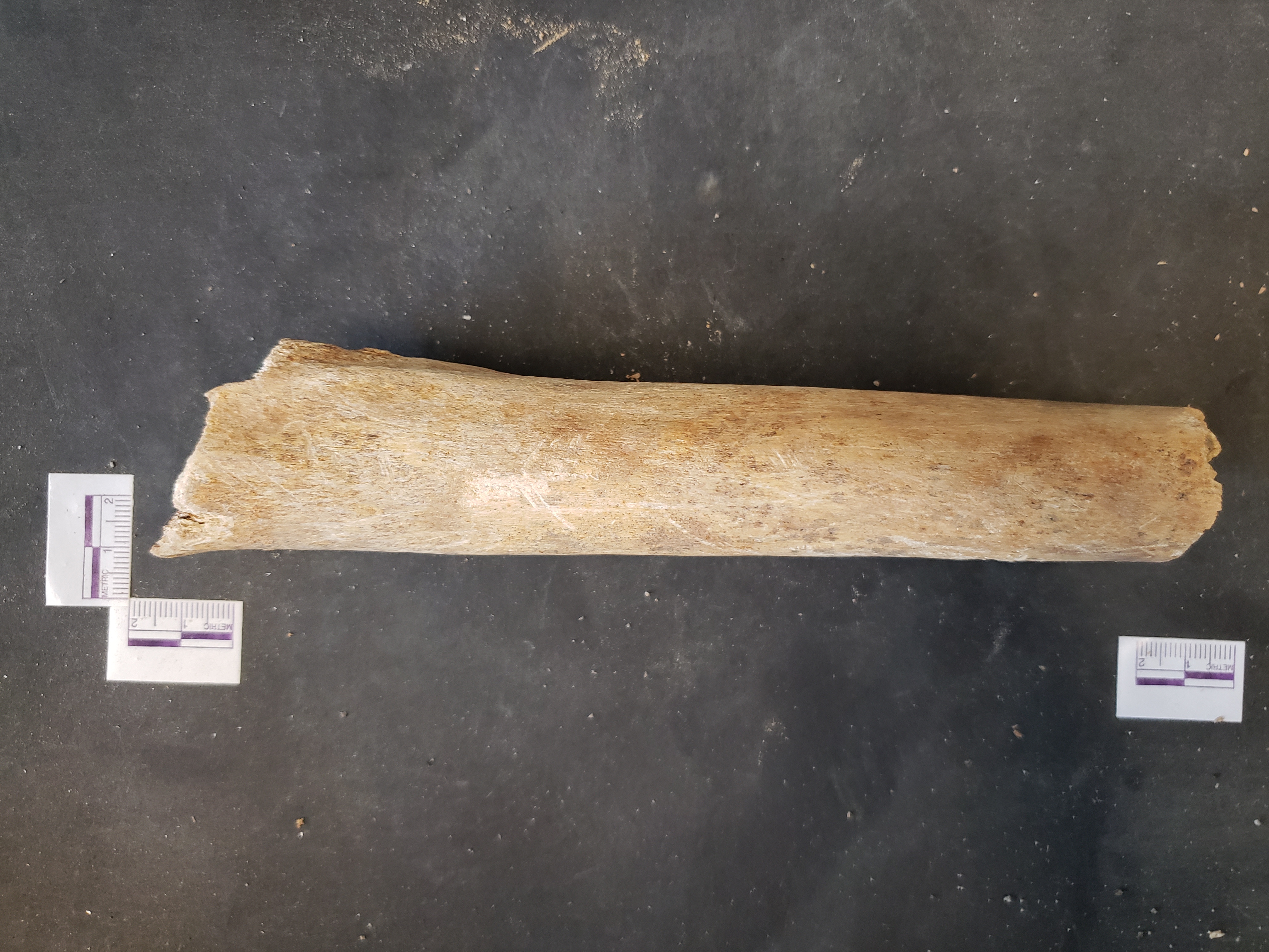 Anterior view