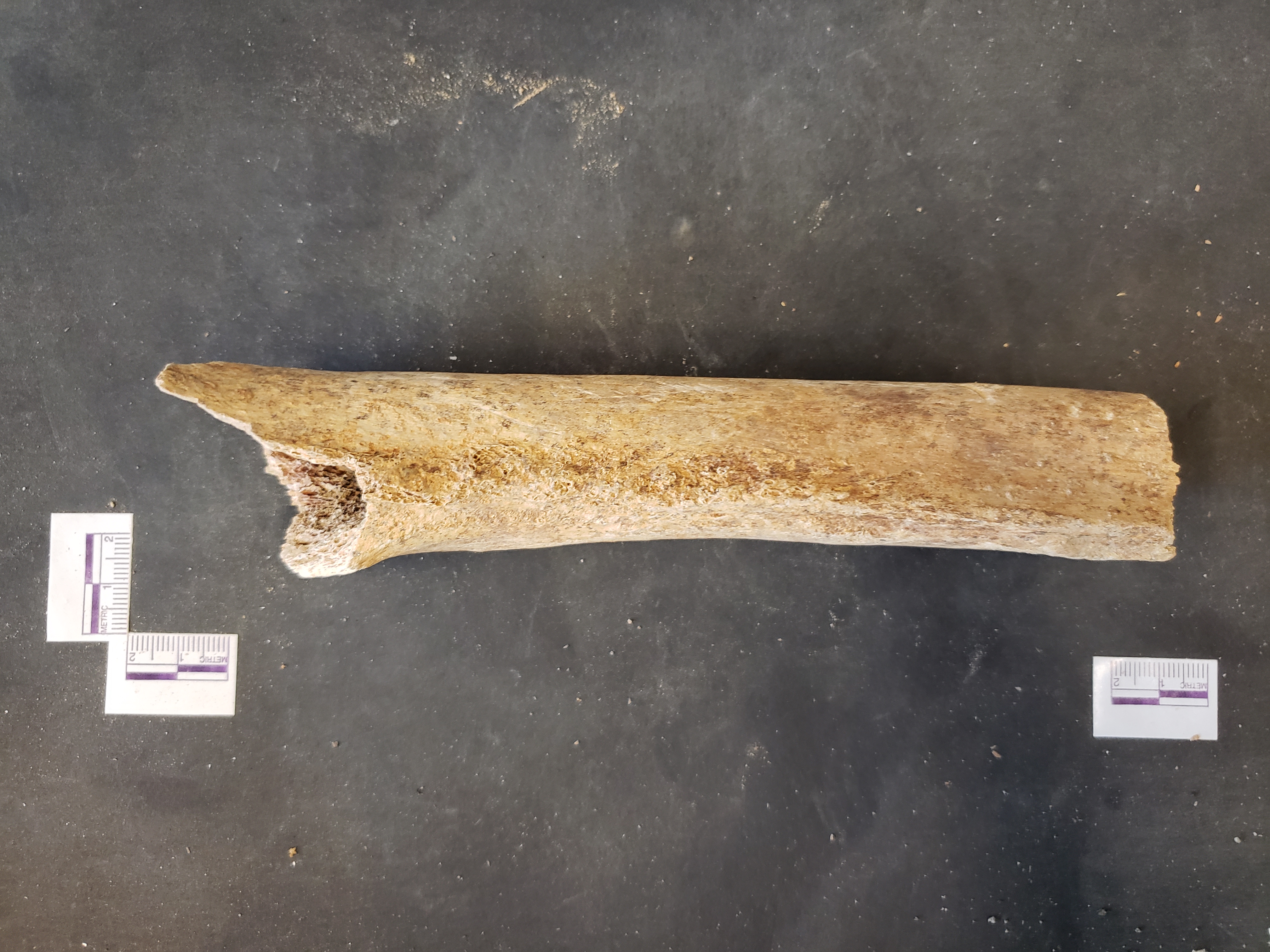 Posterior view