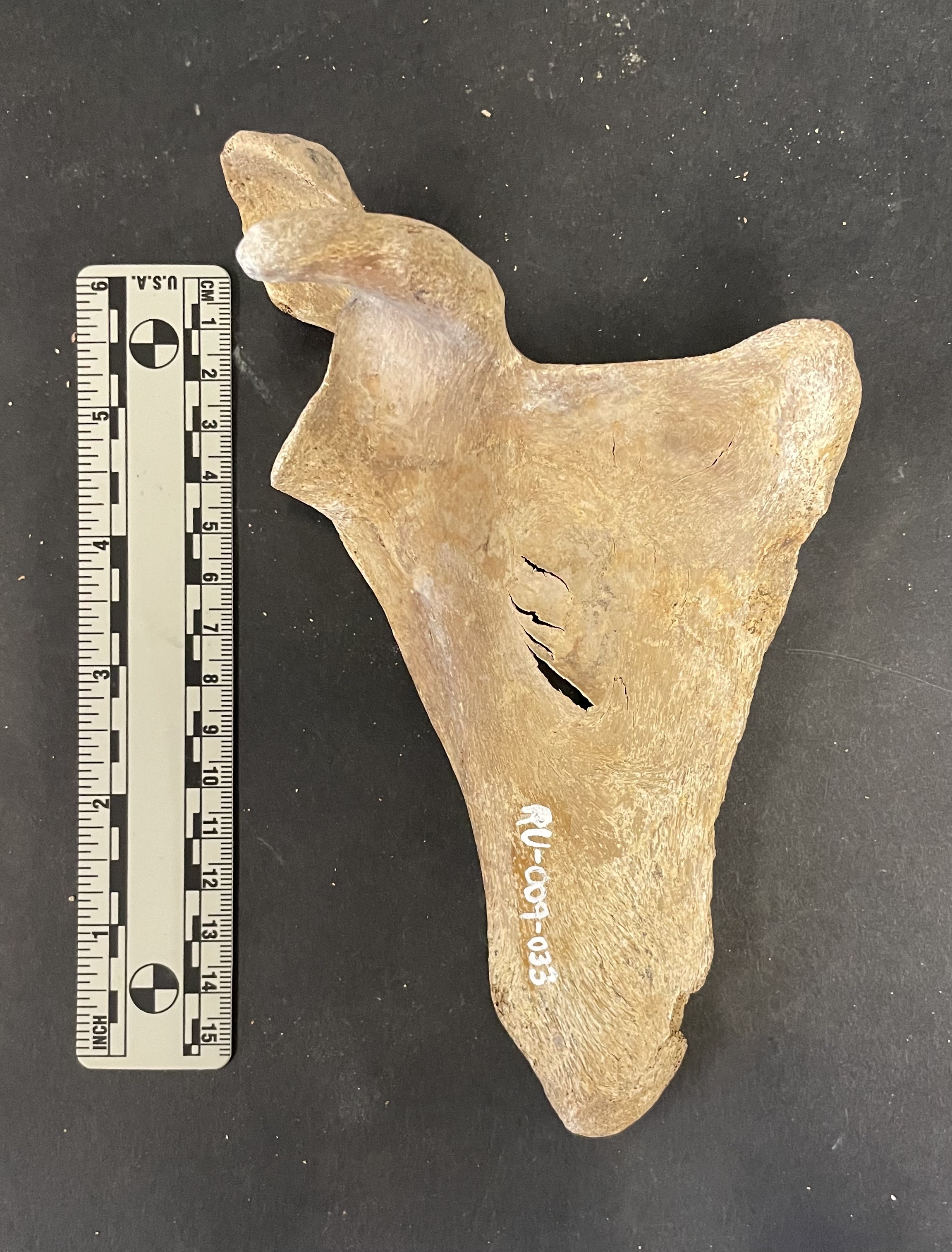 Scapula