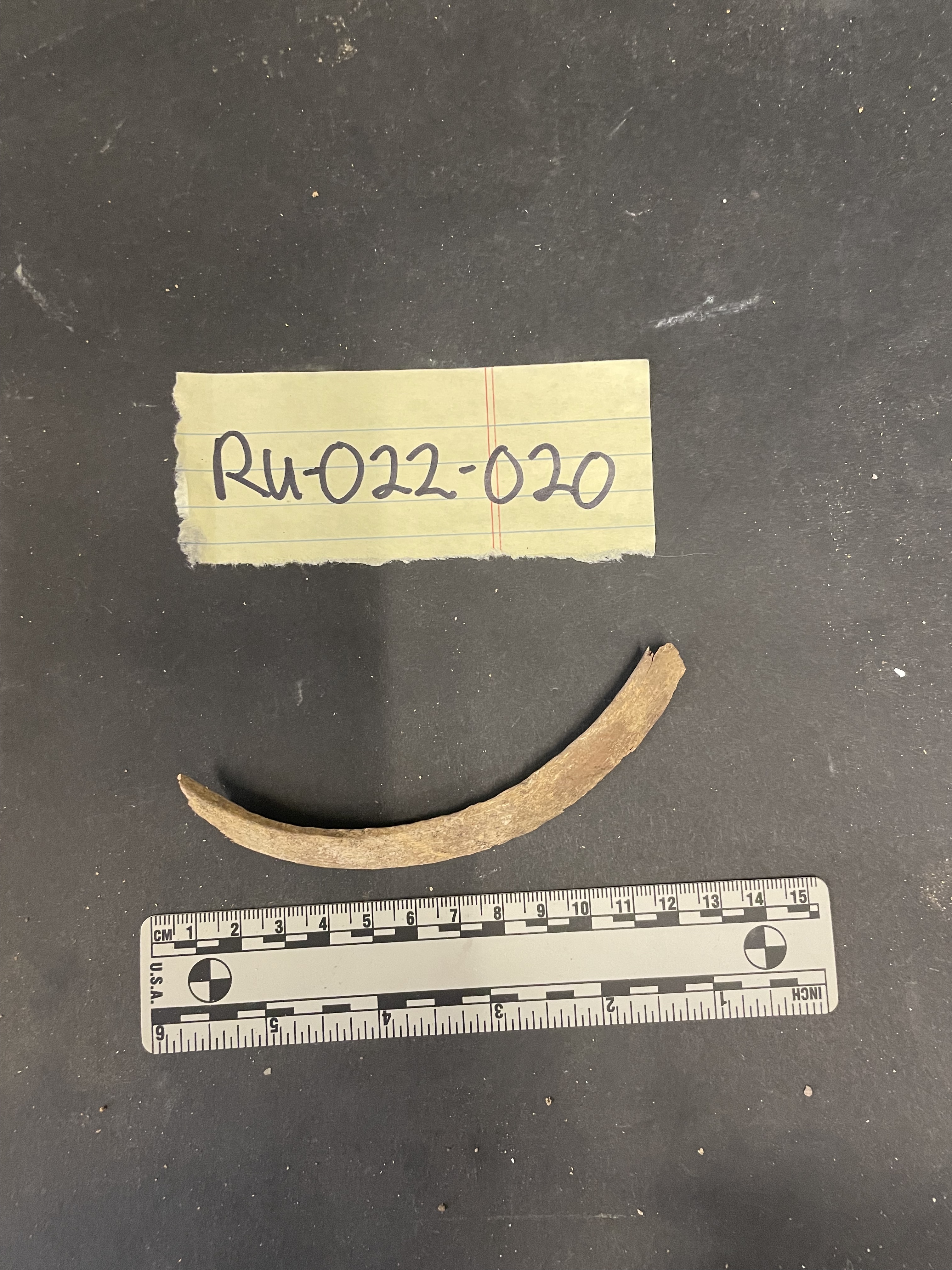 Right Rib