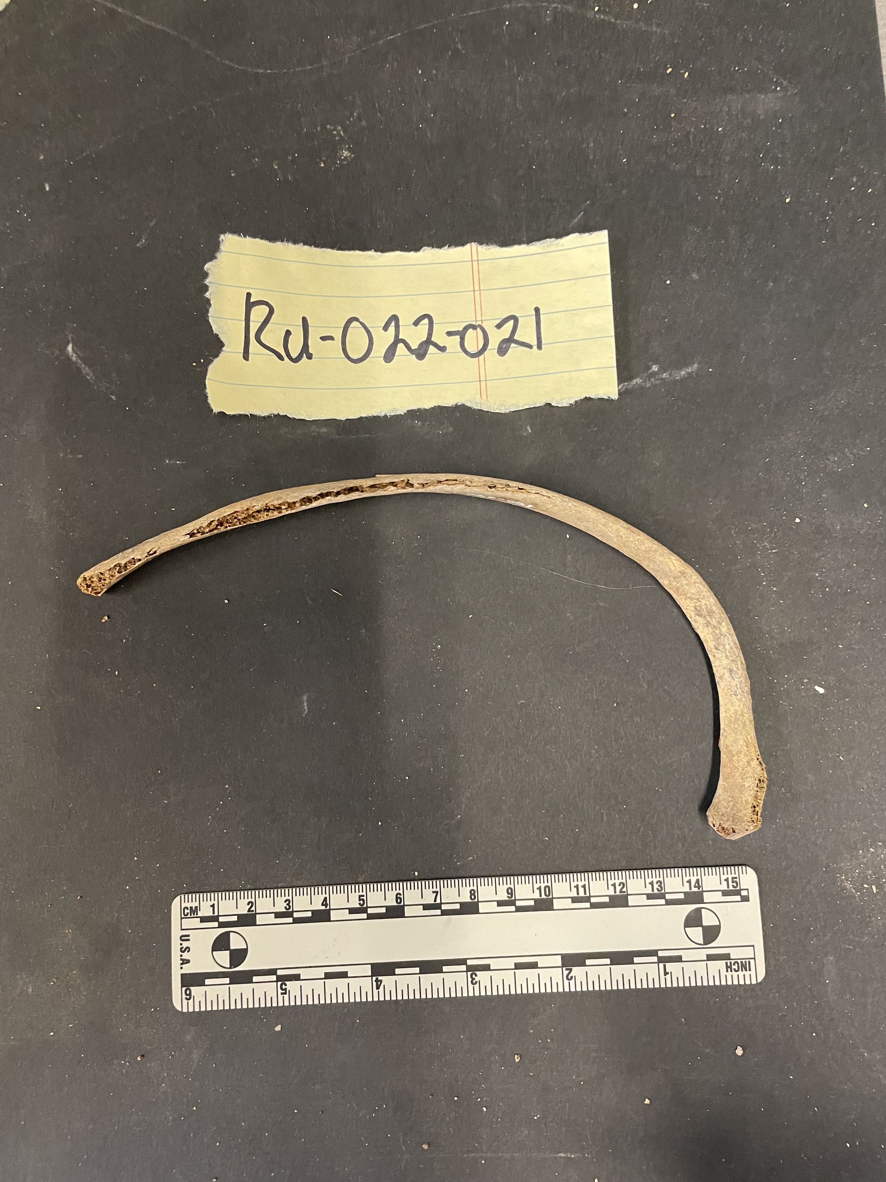 Right Rib