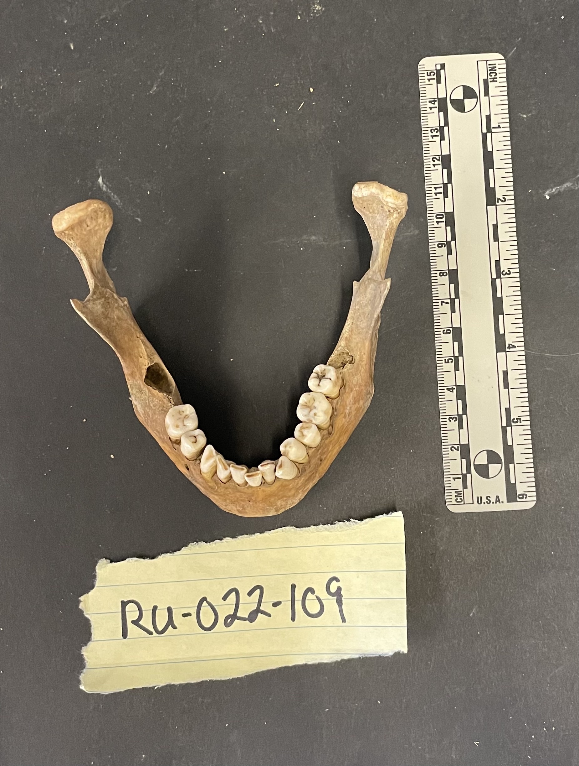 Mandible