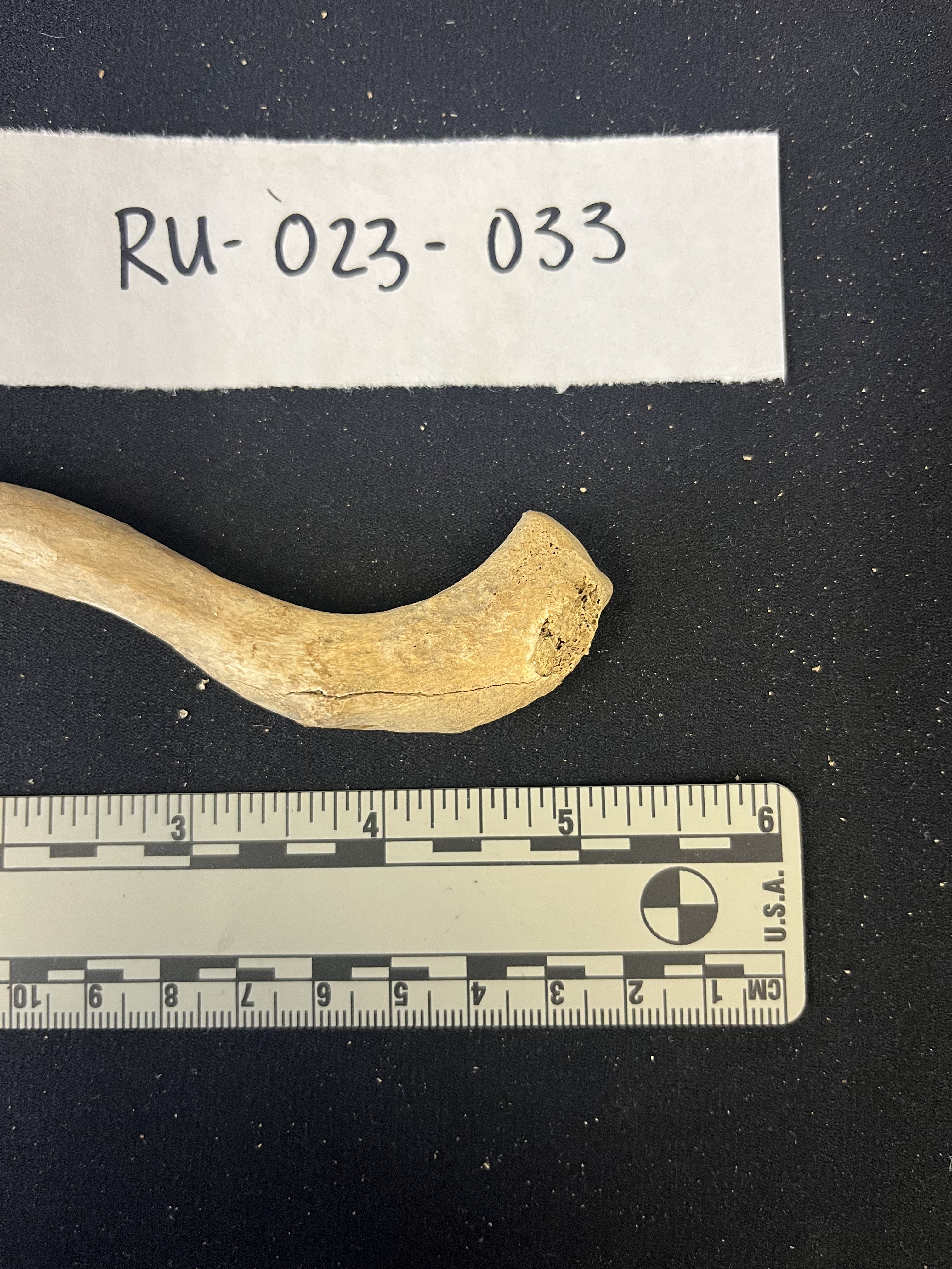 left clavicle inferior acromial end left clavicle inferior acromial end