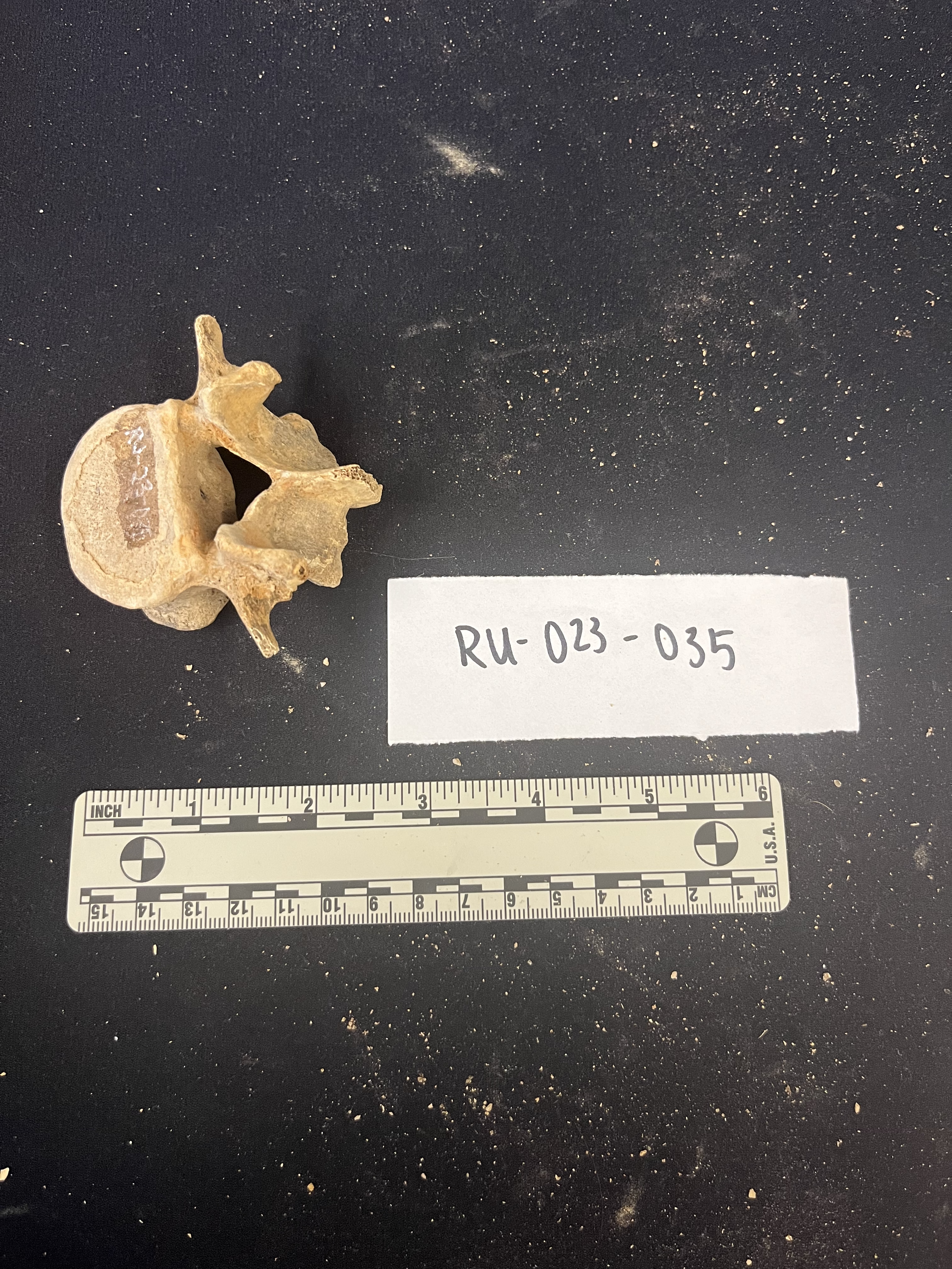 lumbar vertebrae lumbar vertebrae
